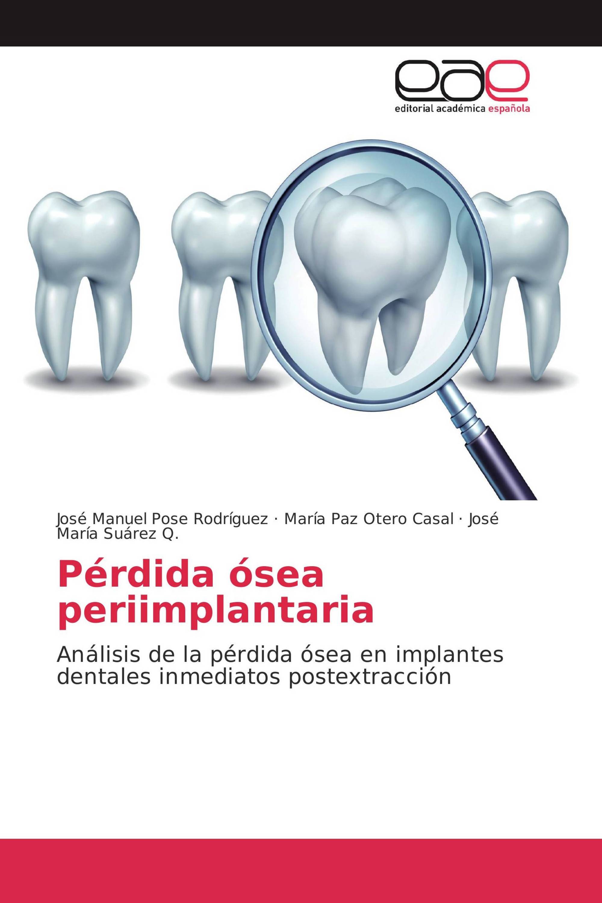 Pérdida ósea periimplantaria