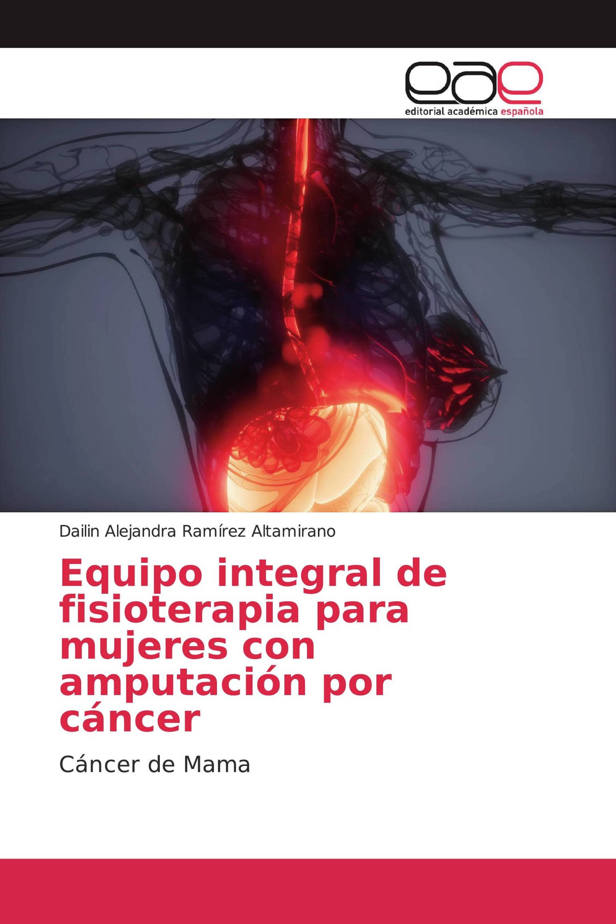 Equipo integral de fisioterapia para mujeres con amputación por cáncer