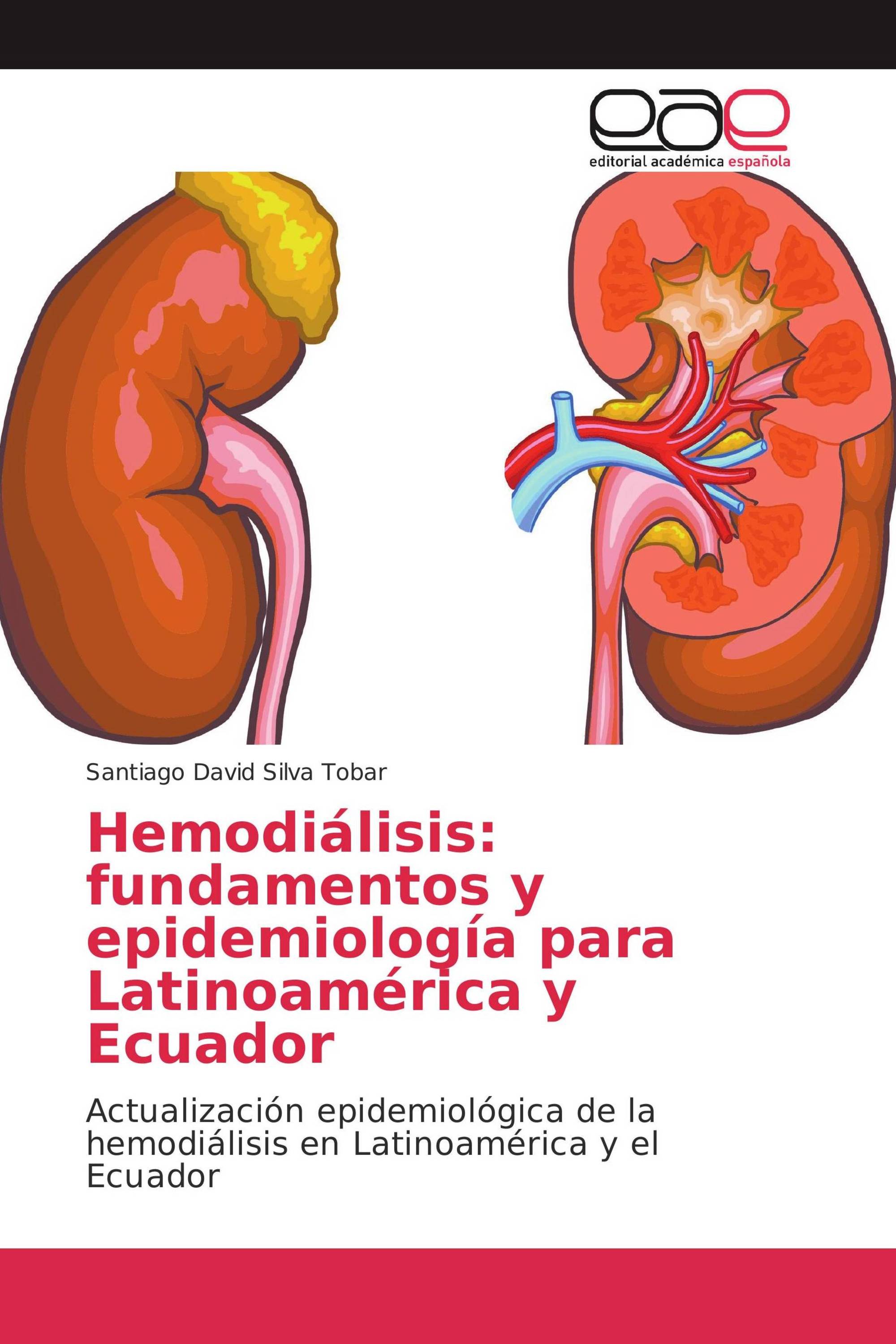 Hemodiálisis: fundamentos y epidemiología para Latinoamérica y Ecuador