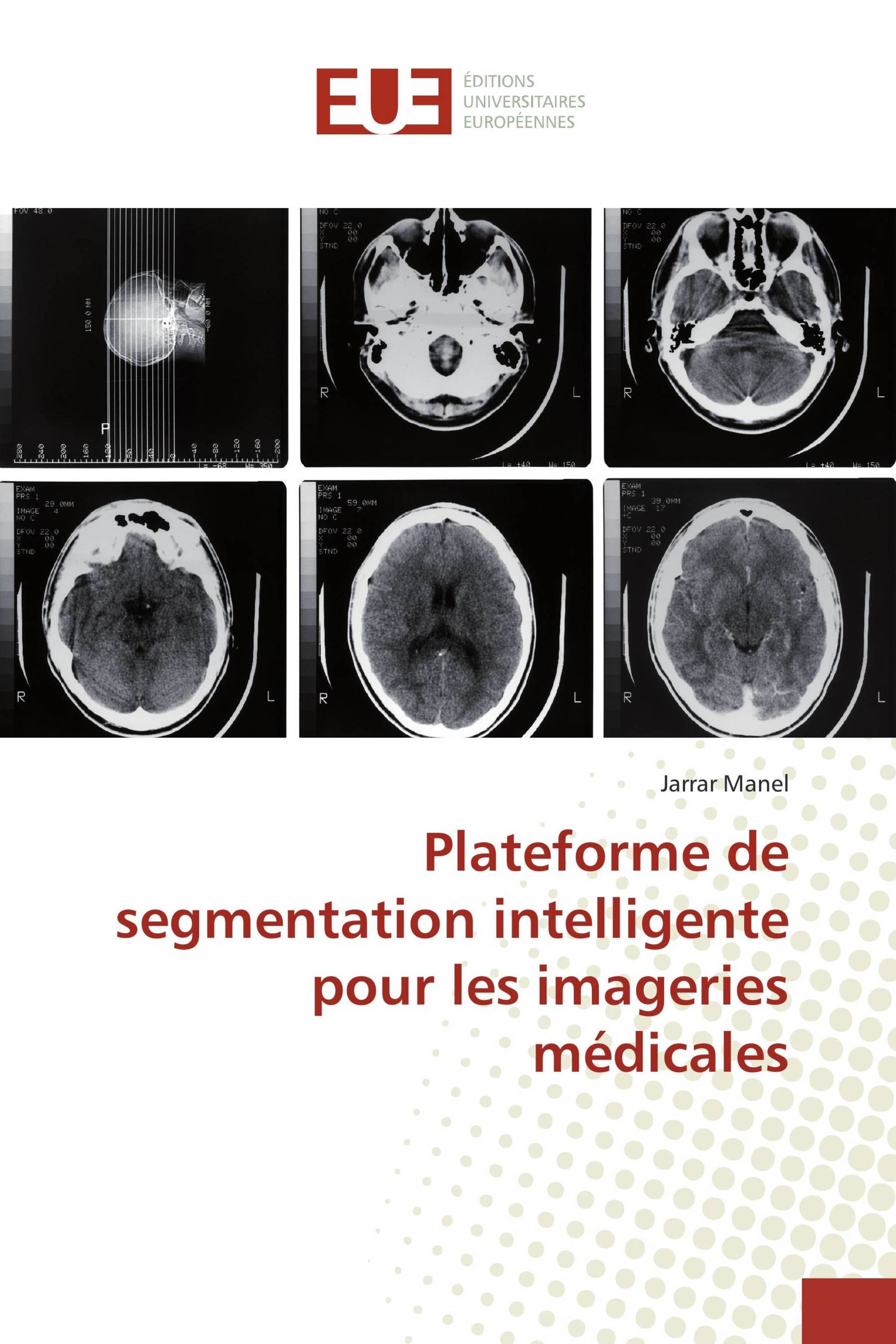 Plateforme de segmentation intelligente pour les imageries médicales