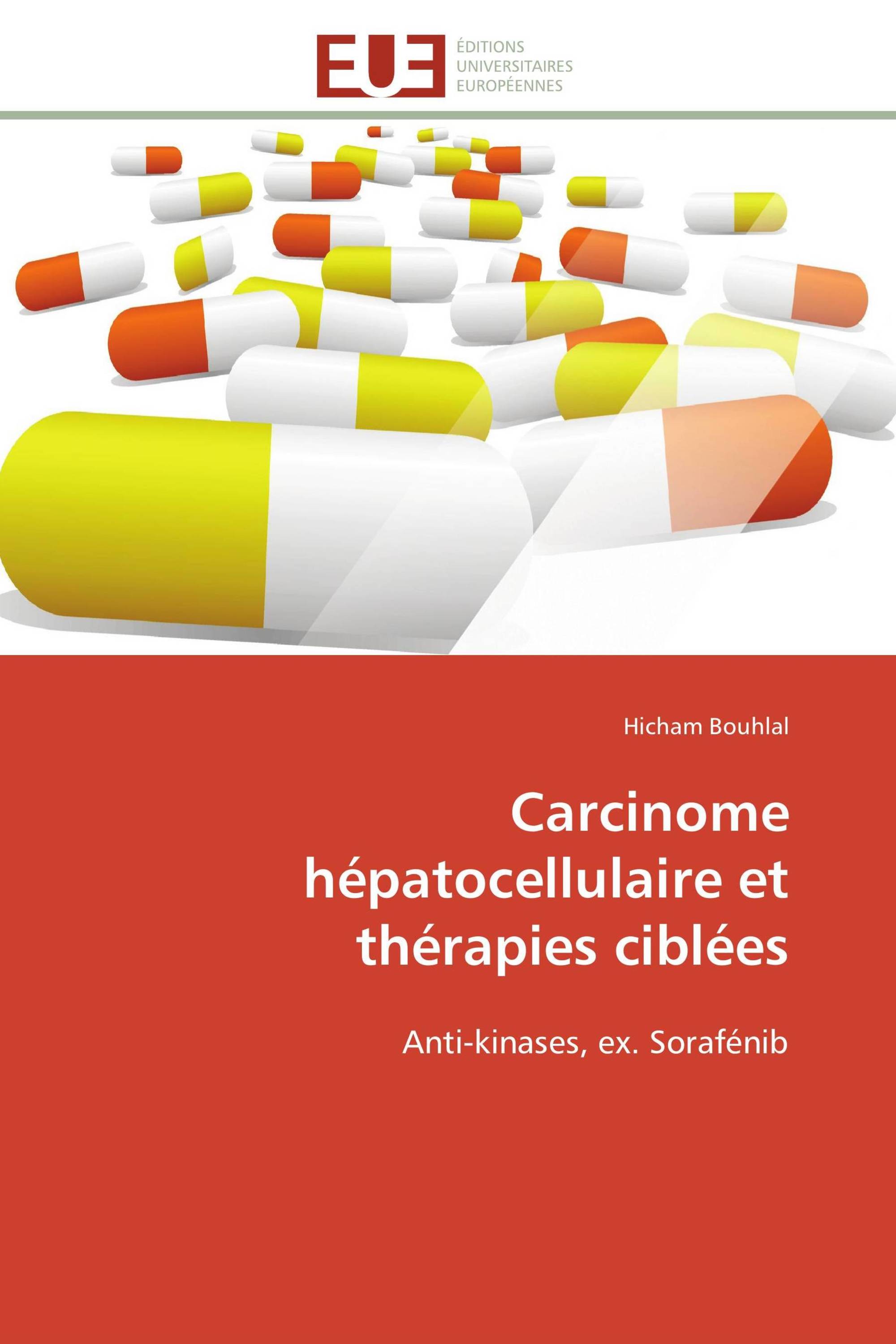 Carcinome hépatocellulaire et thérapies ciblées