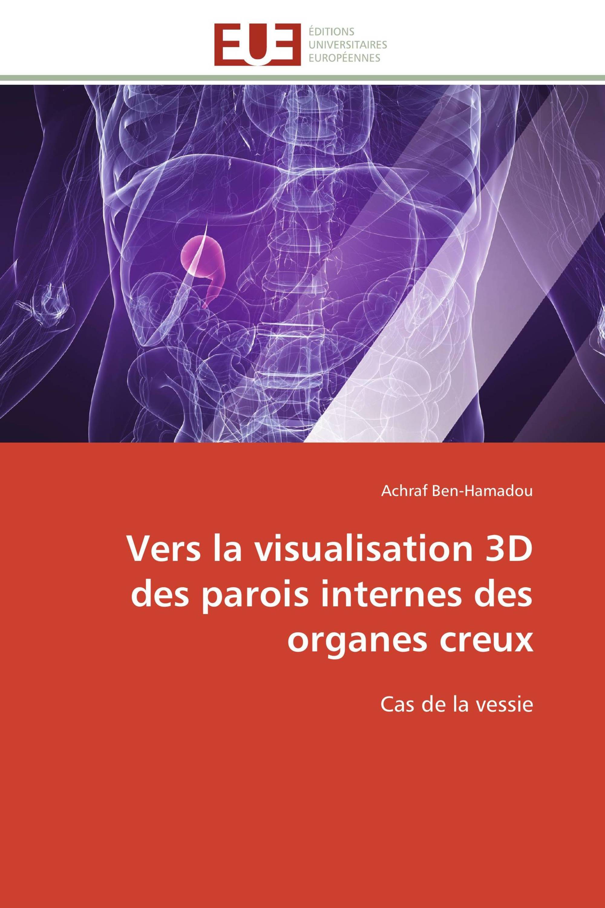 Vers la visualisation 3D des parois internes des organes creux