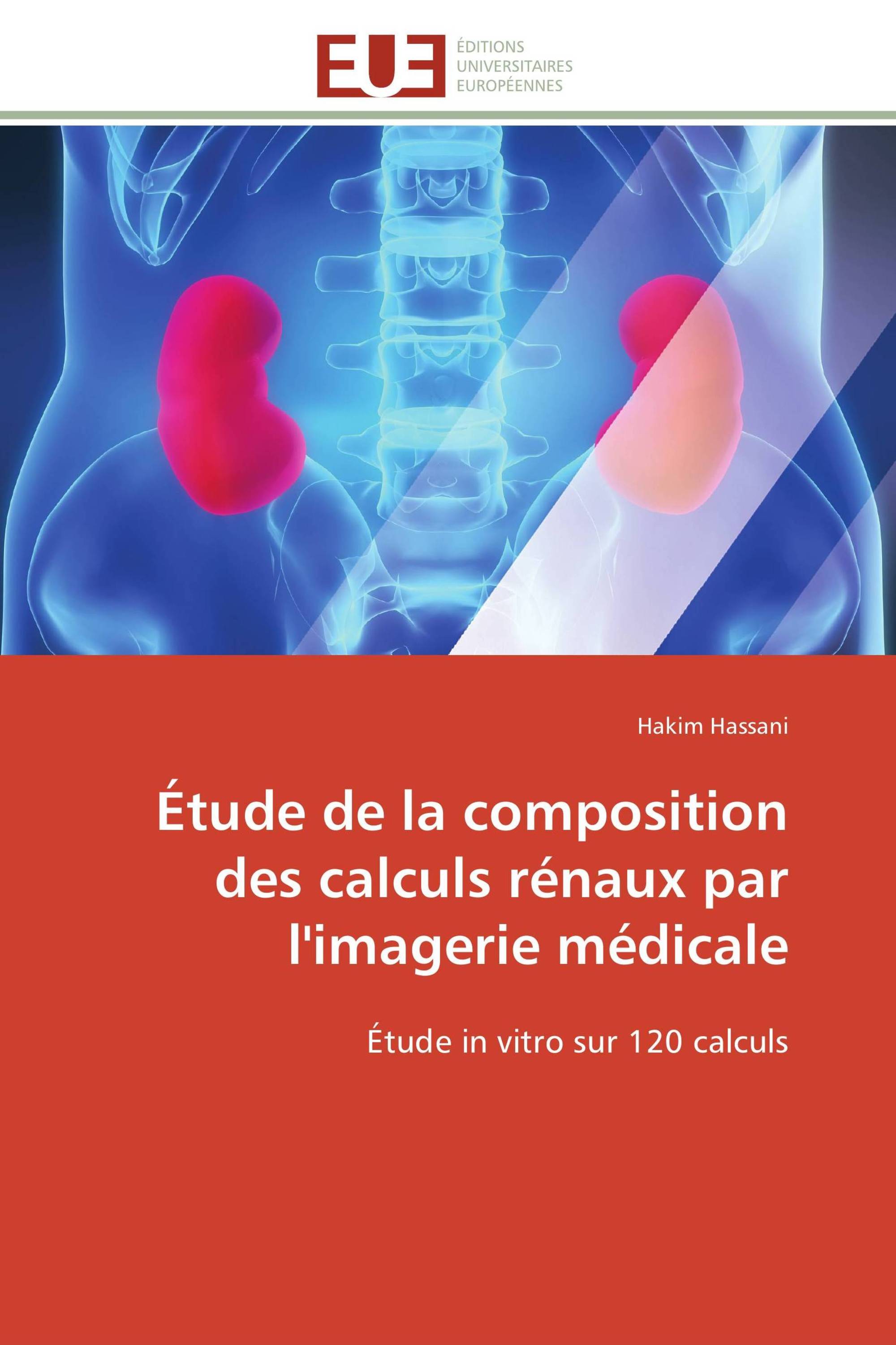 Étude de la composition des calculs rénaux par l'imagerie médicale