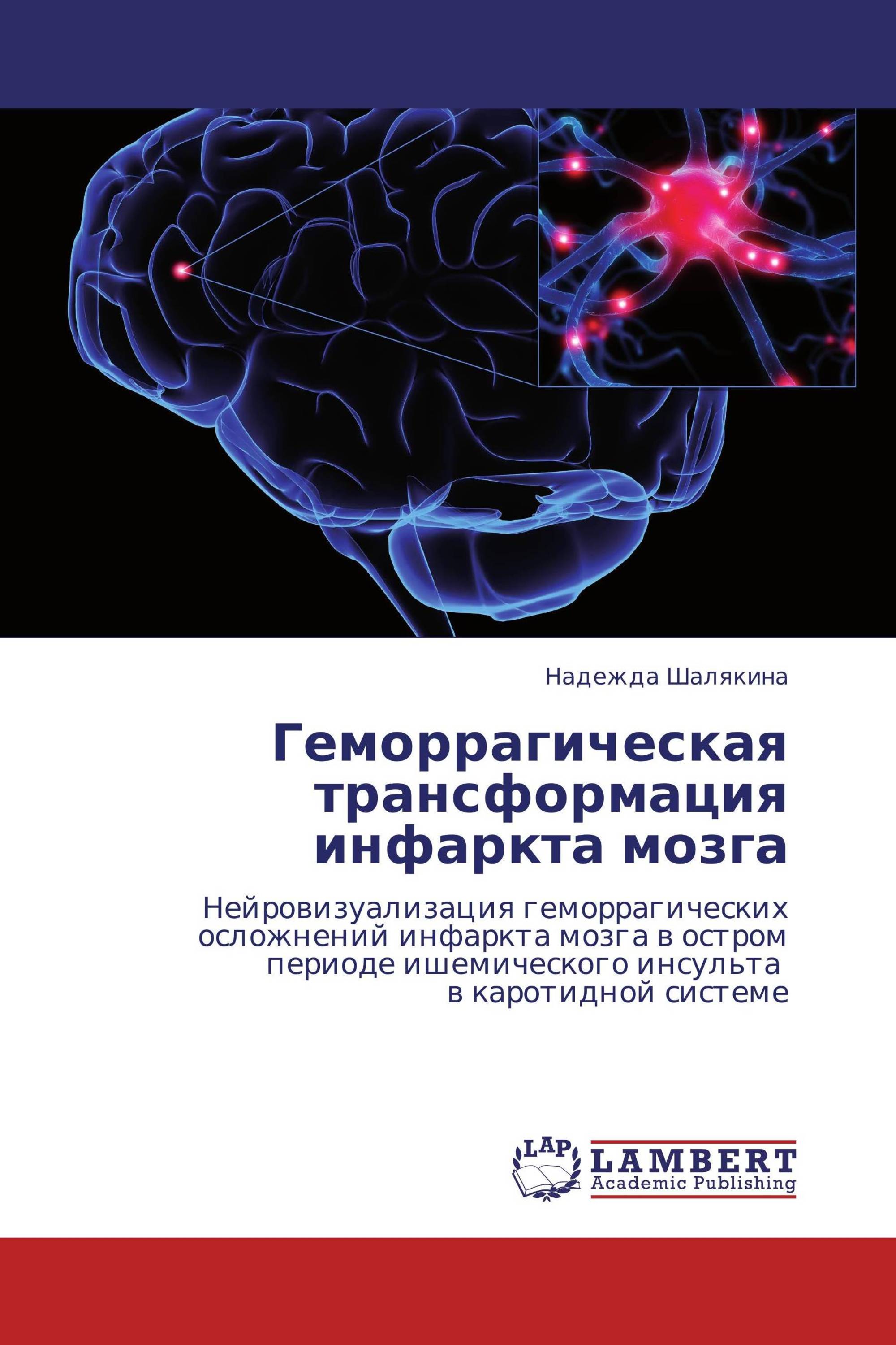 Геморрагическая трансформация инфаркта мозга