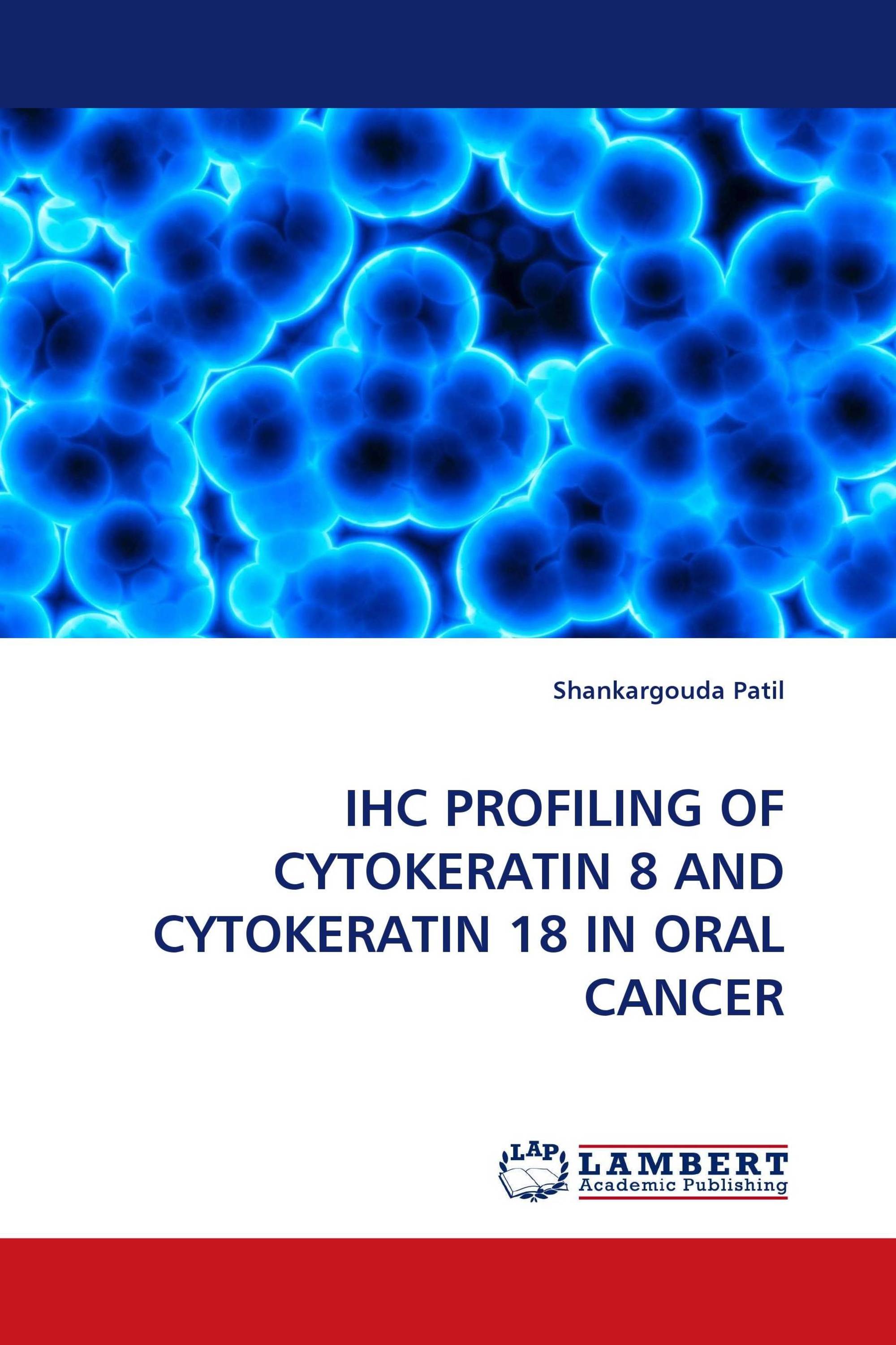 IHC PROFILING OF CYTOKERATIN 8 AND CYTOKERATIN 18 IN ORAL CANCER