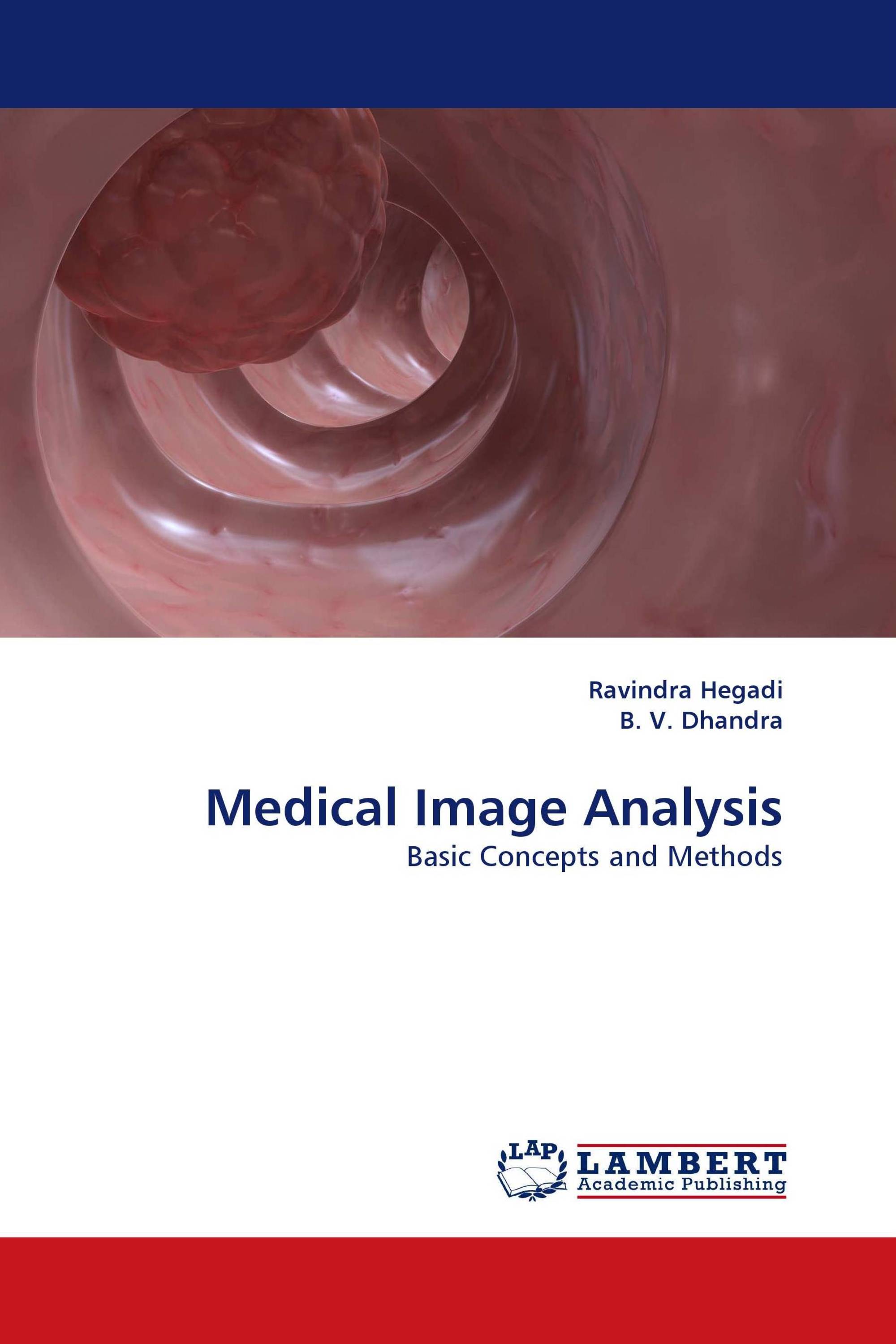 Medical Image Analysis 978 3 8433 5835 4 9783843358354