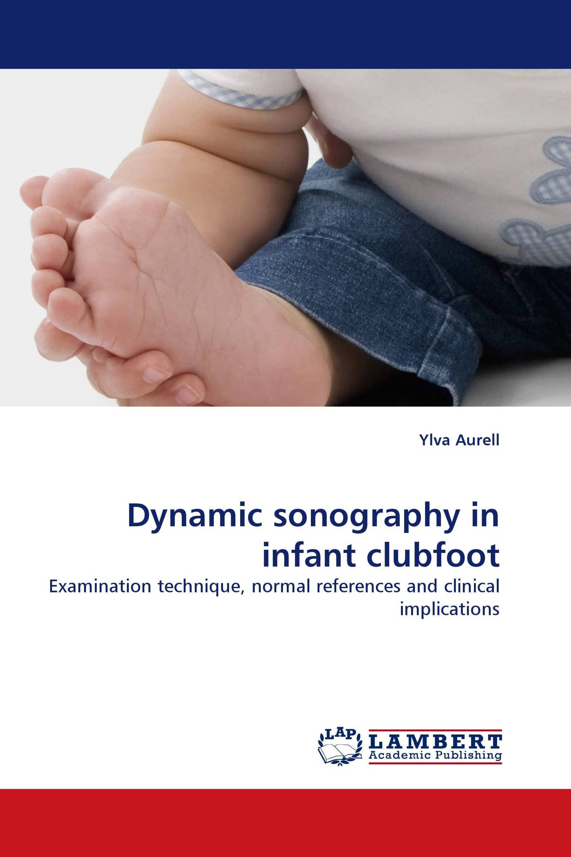 Dynamic sonography in infant clubfoot