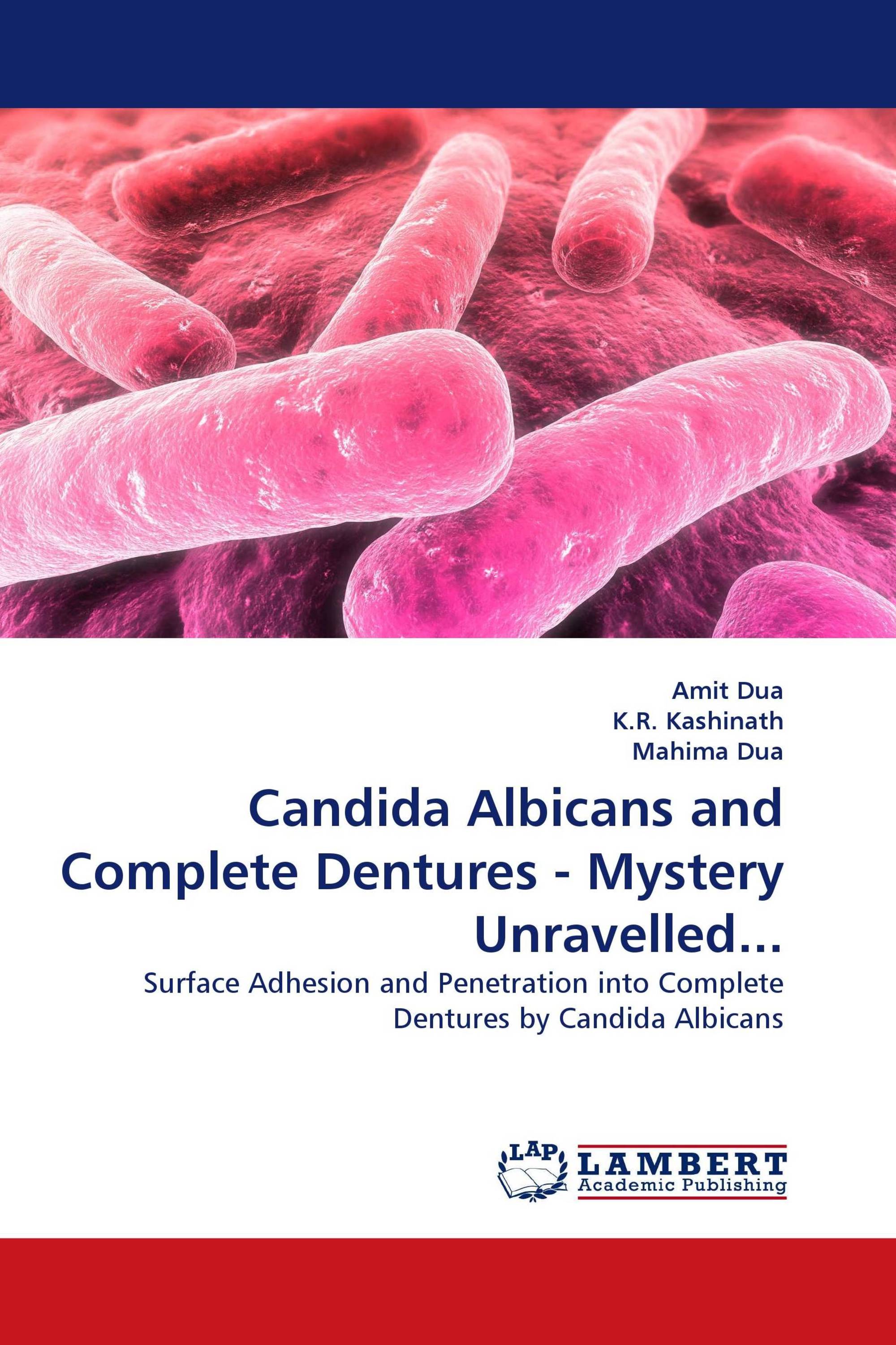 Candida Albicans and Complete Dentures - Mystery Unravelled...