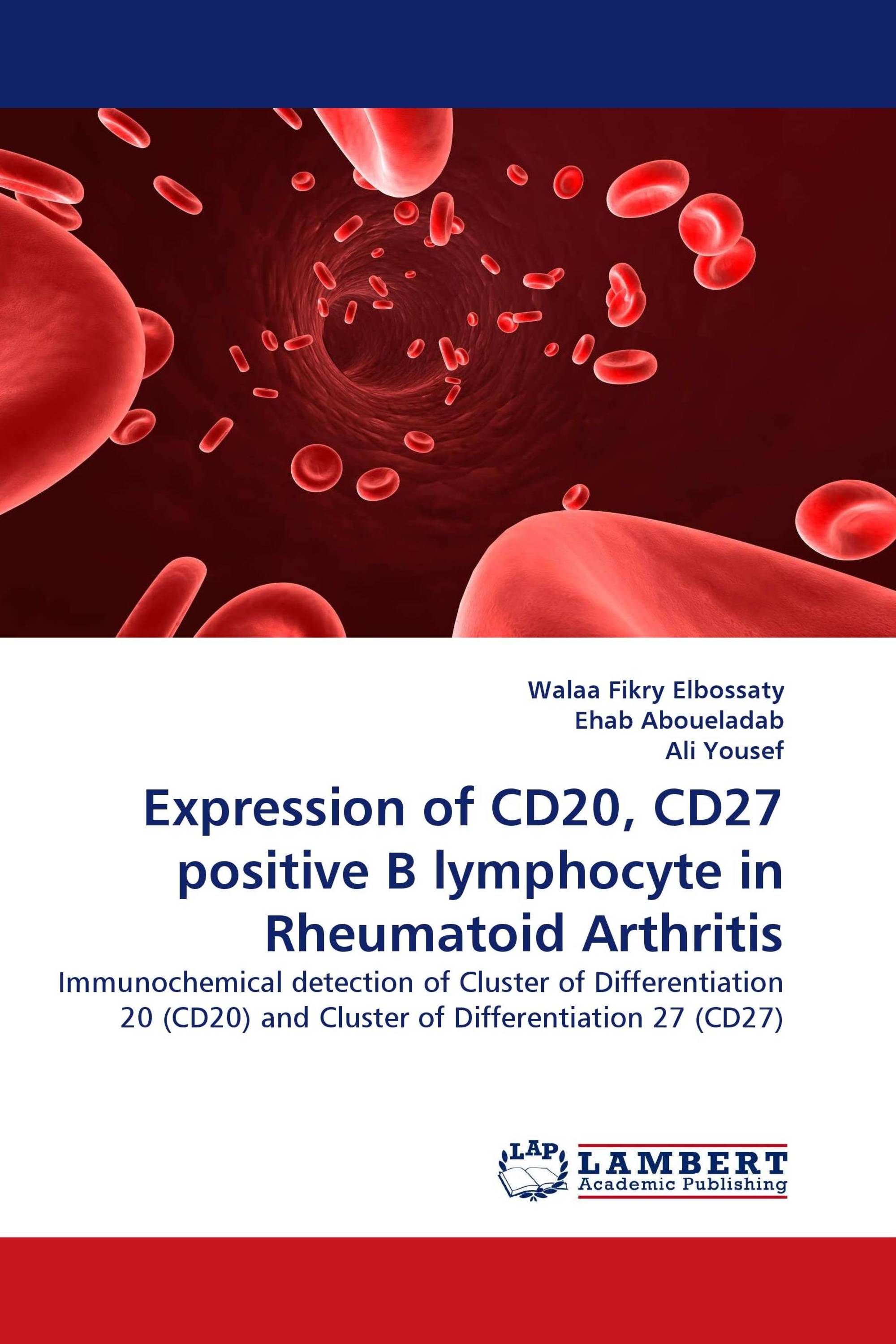 Expression of CD20, CD27 positive B lymphocyte in Rheumatoid Arthritis