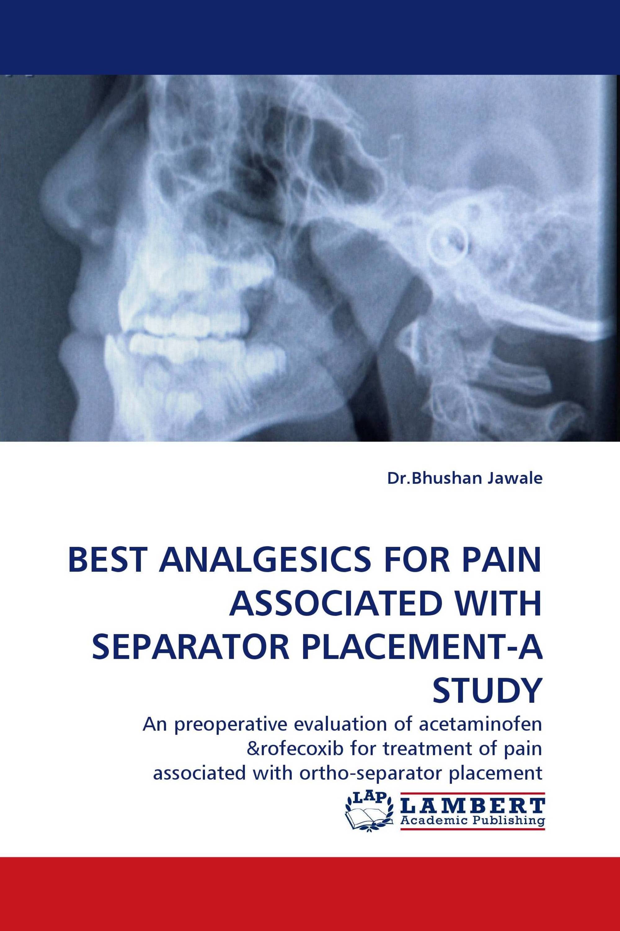 BEST ANALGESICS FOR PAIN ASSOCIATED WITH SEPARATOR PLACEMENT-A STUDY