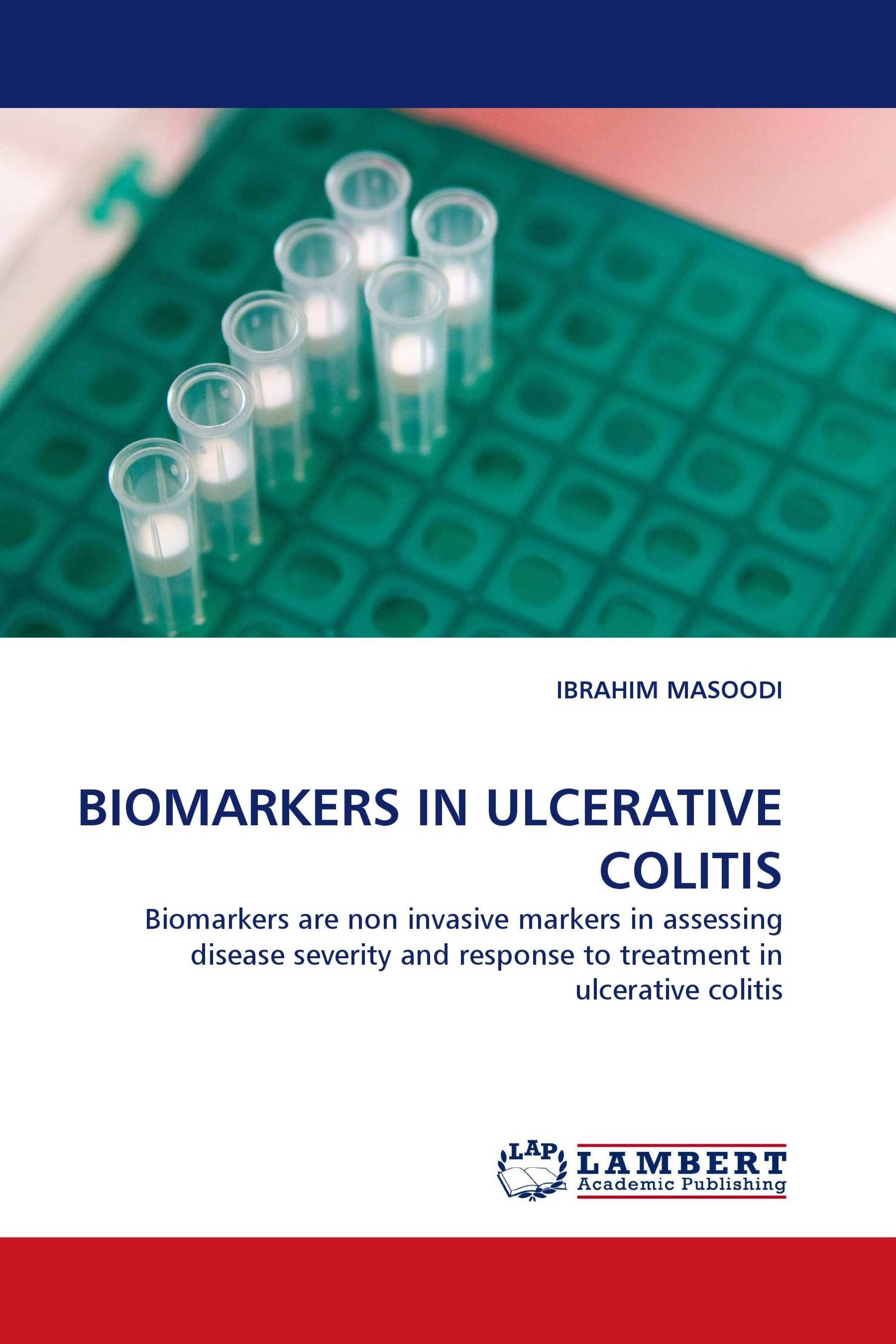 BIOMARKERS IN ULCERATIVE COLITIS