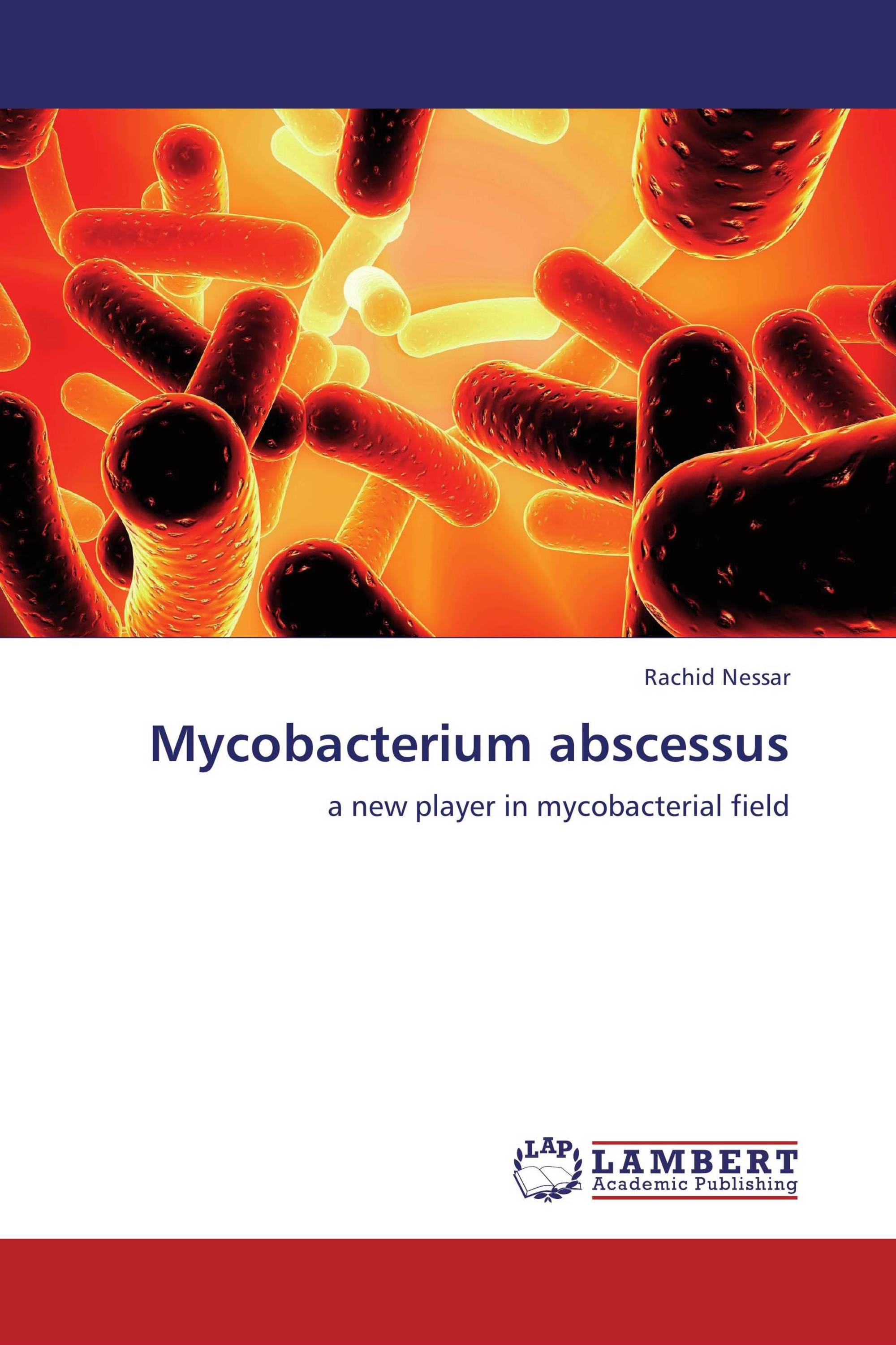 Mycobacterium abscessus