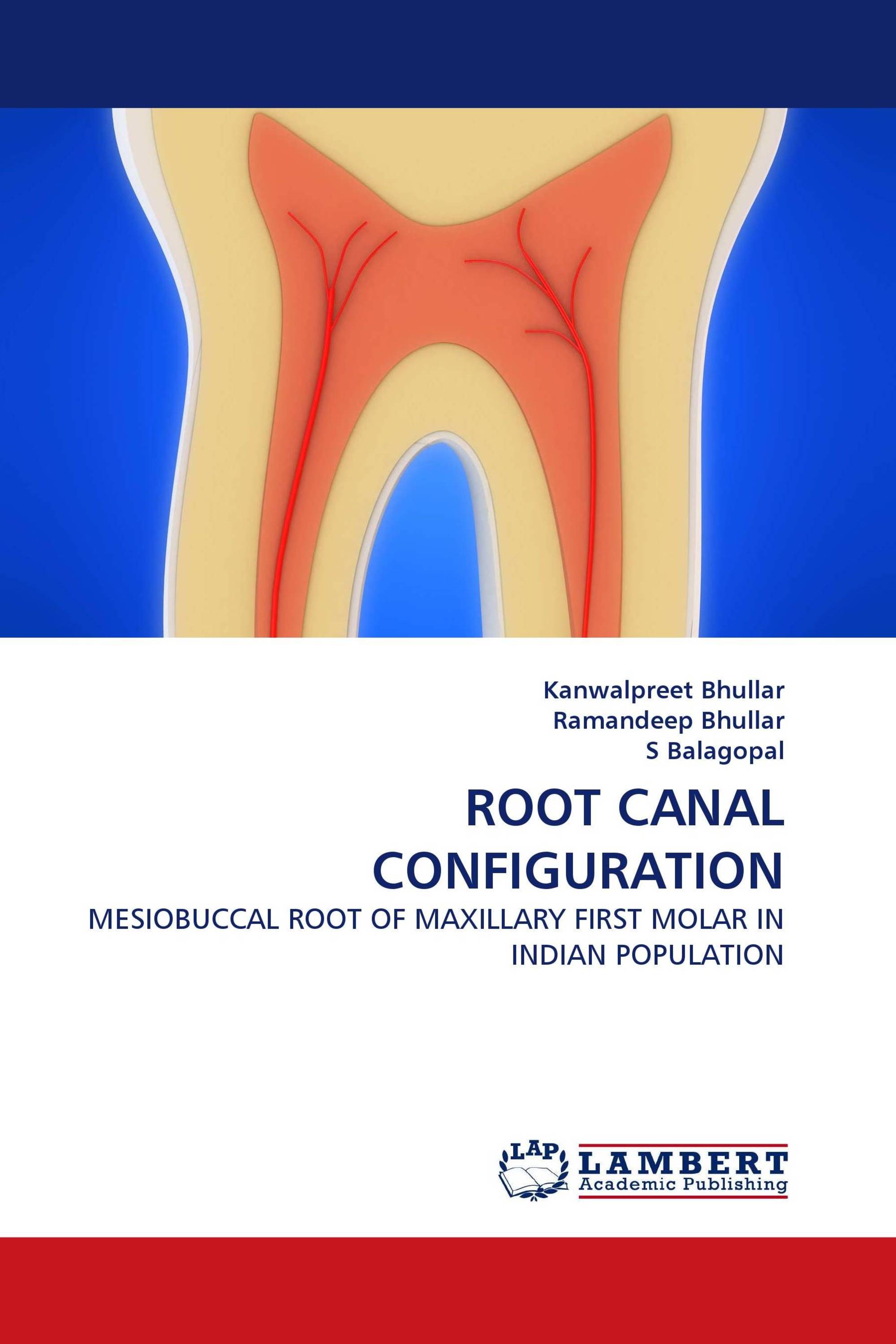 ROOT CANAL CONFIGURATION