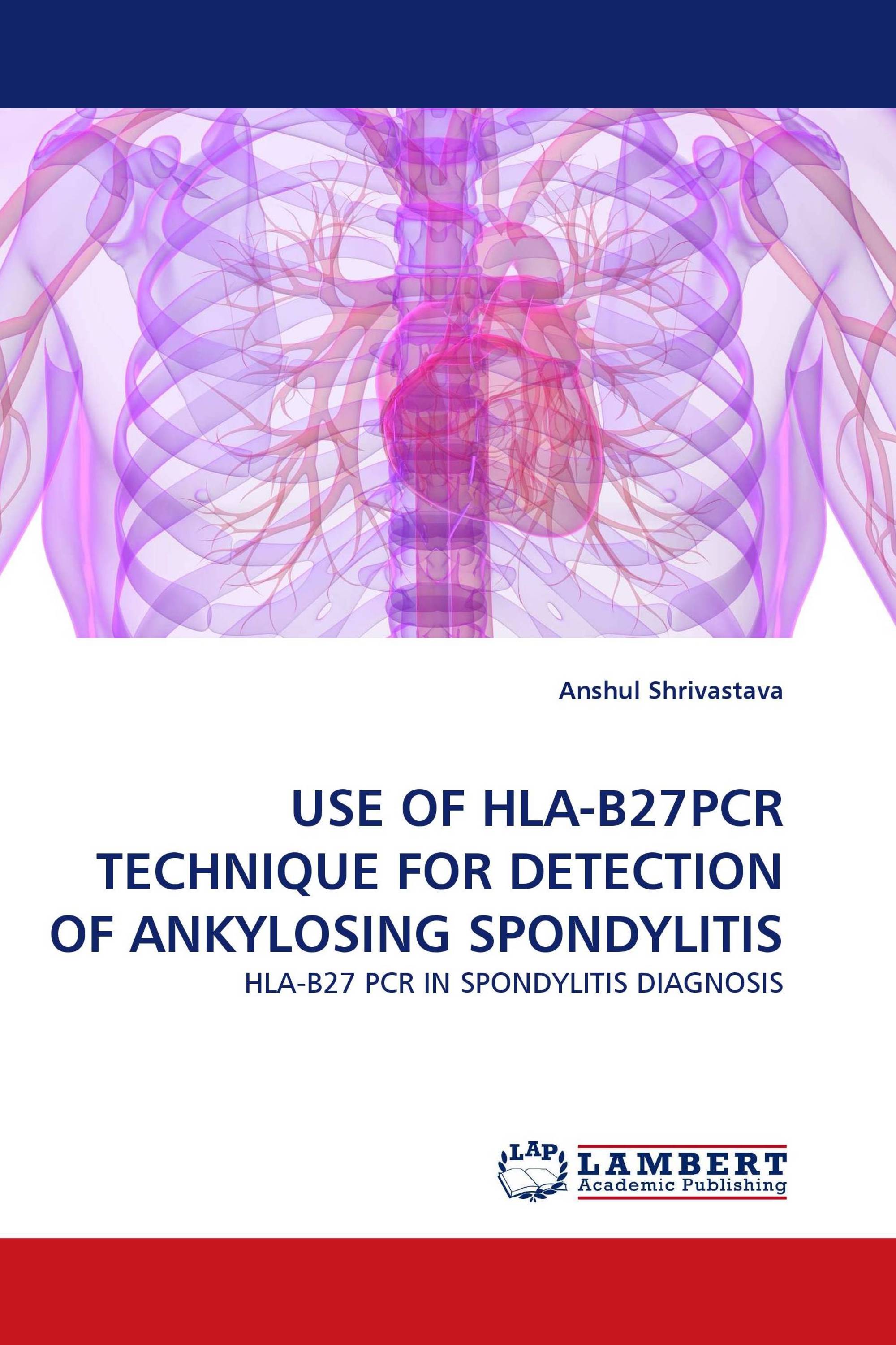 USE OF HLA-B27PCR TECHNIQUE FOR DETECTION OF ANKYLOSING SPONDYLITIS