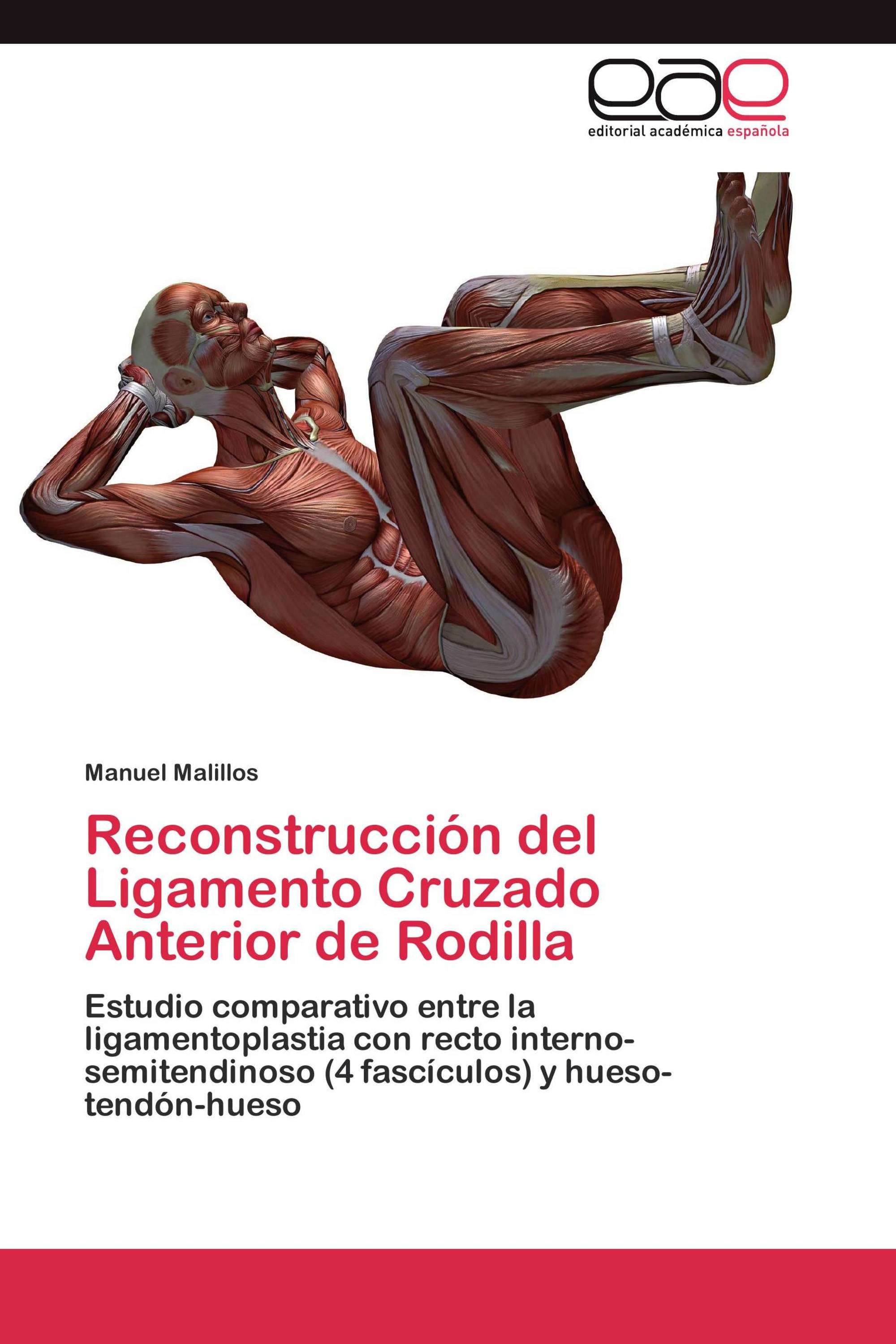 Reconstrucción del Ligamento Cruzado Anterior de Rodilla