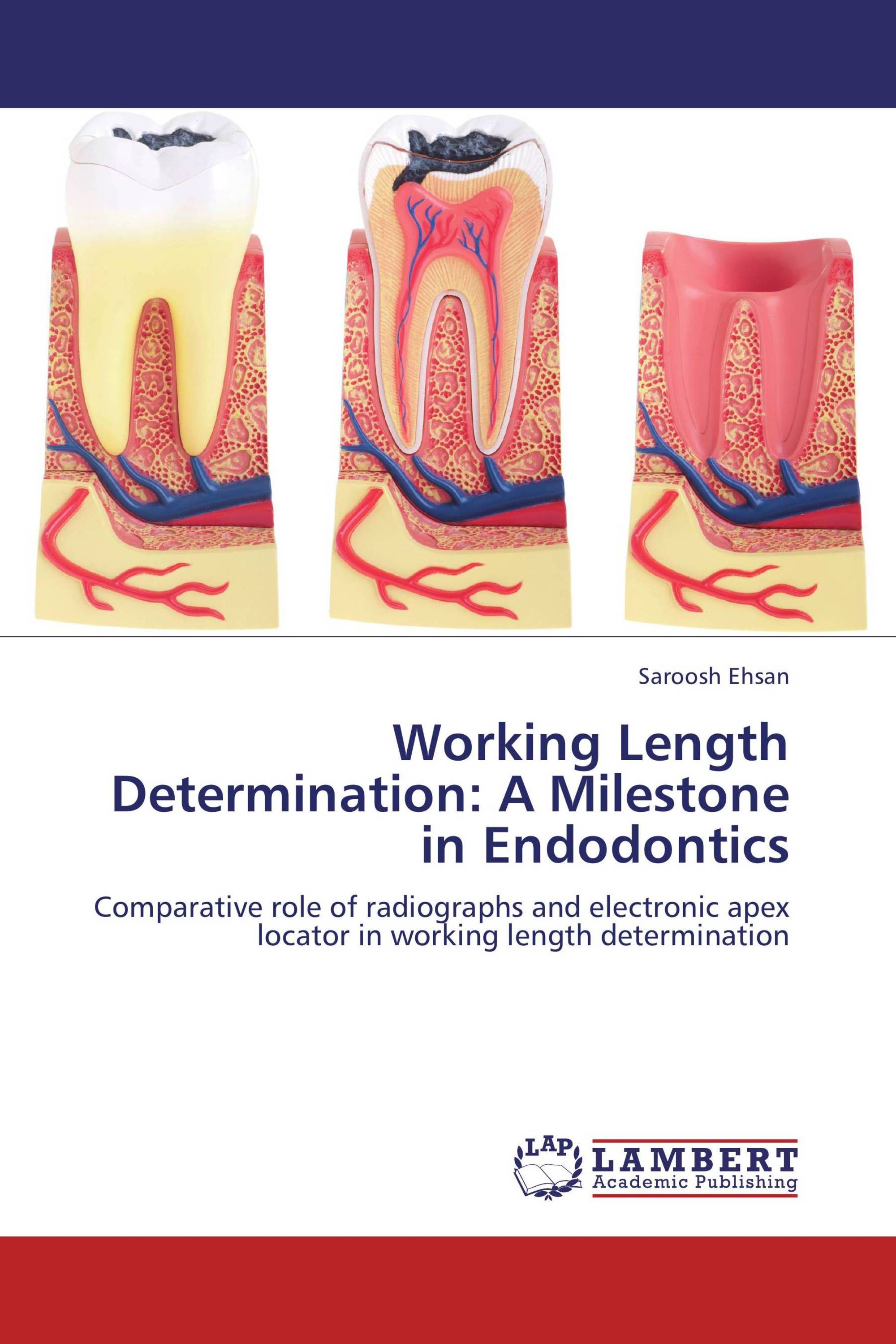 Working Length Determination A Milestone in Endodontics / 97838443