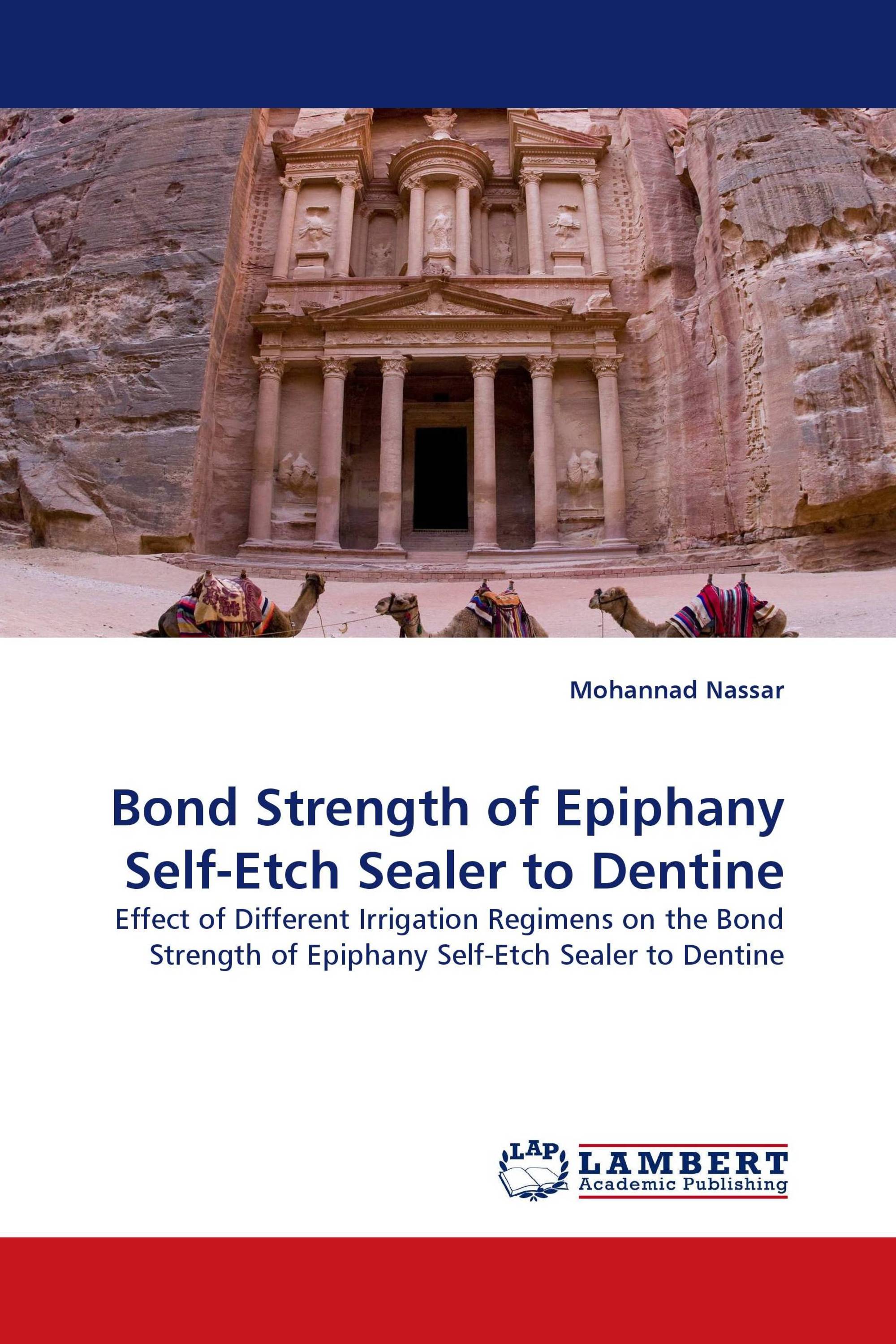 Bond Strength of Epiphany Self-Etch Sealer to Dentine