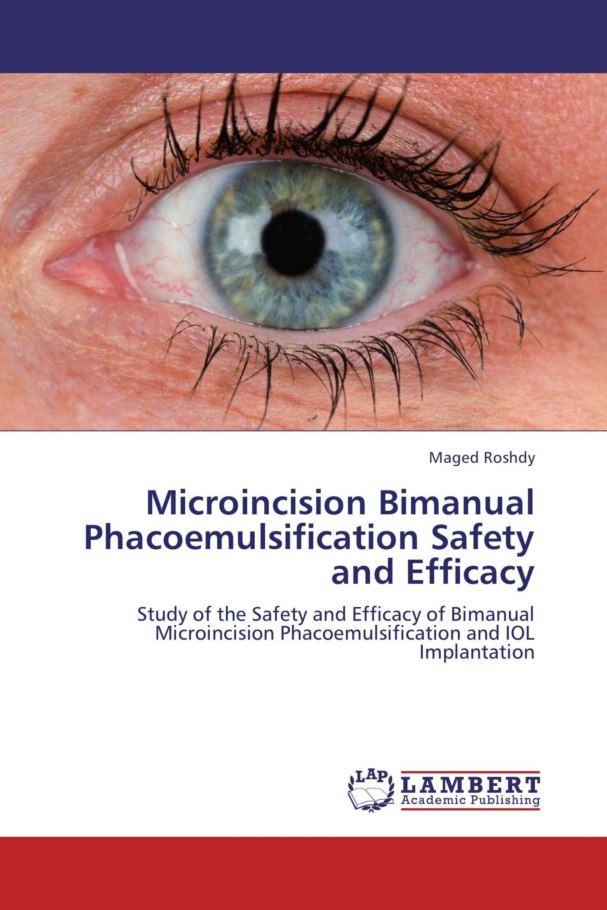 Microincision Bimanual Phacoemulsification Safety and Efficacy