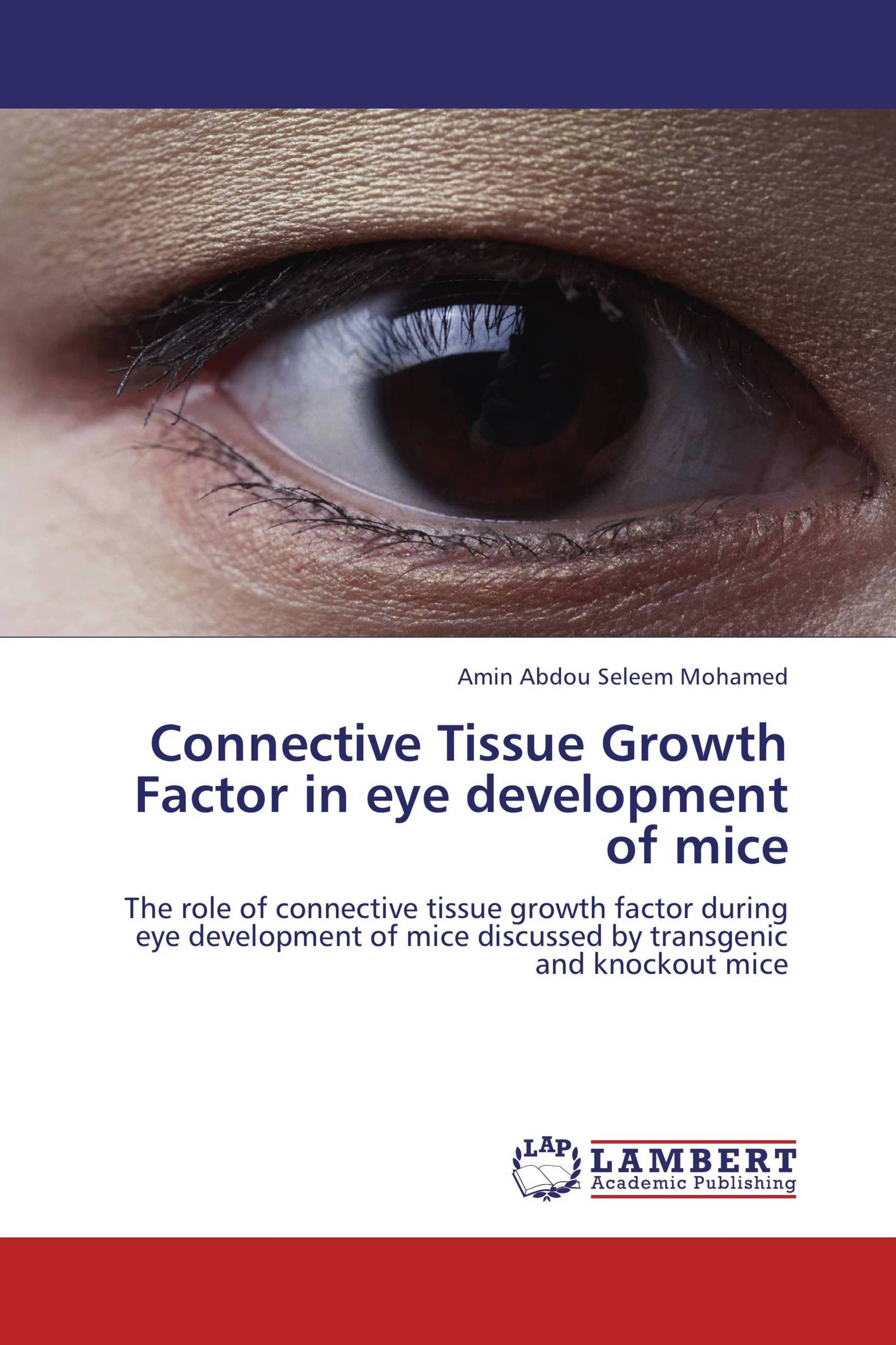 Connective Tissue Growth Factor in  eye development of mice