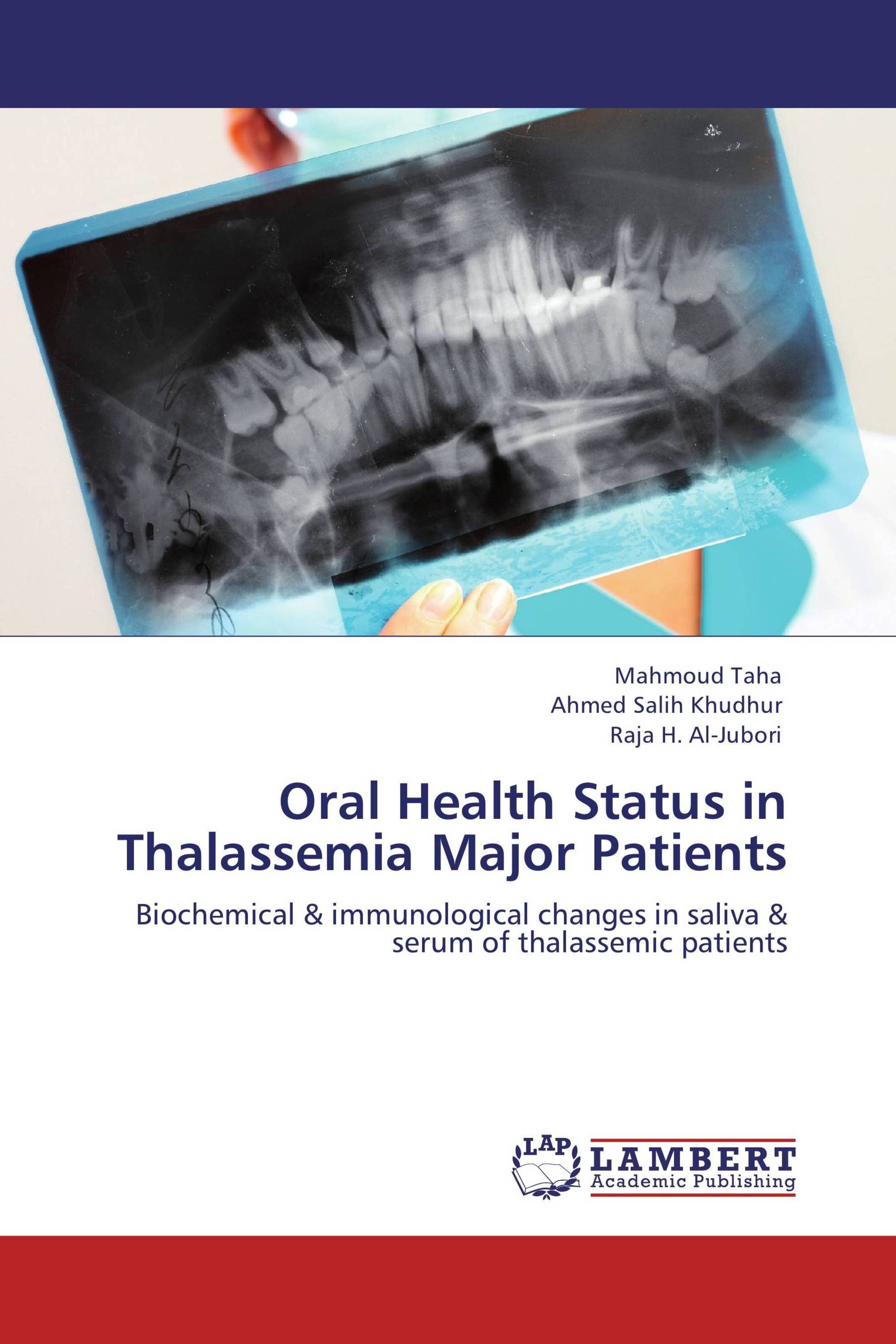 Oral Health Status in Thalassemia Major Patients