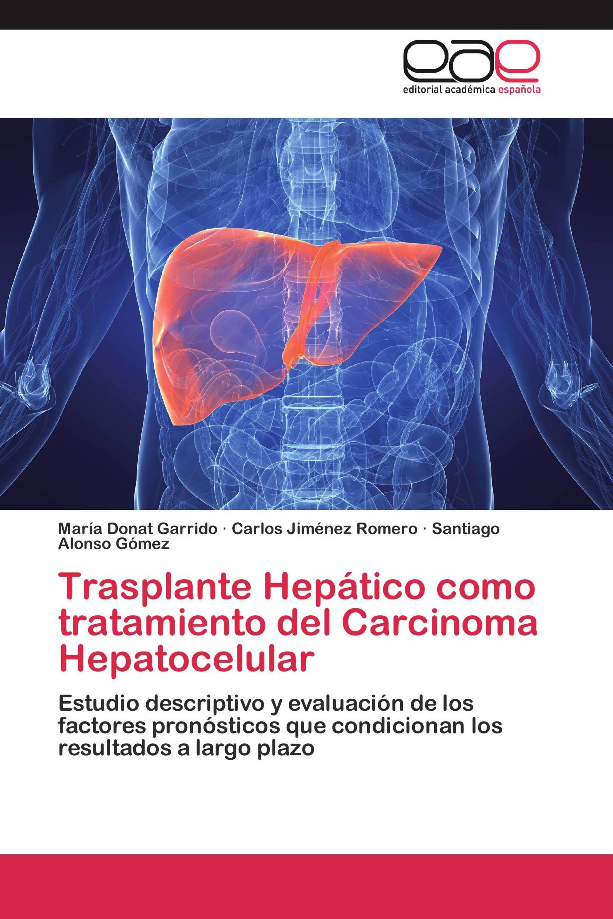 Trasplante Hepático como tratamiento del Carcinoma Hepatocelular