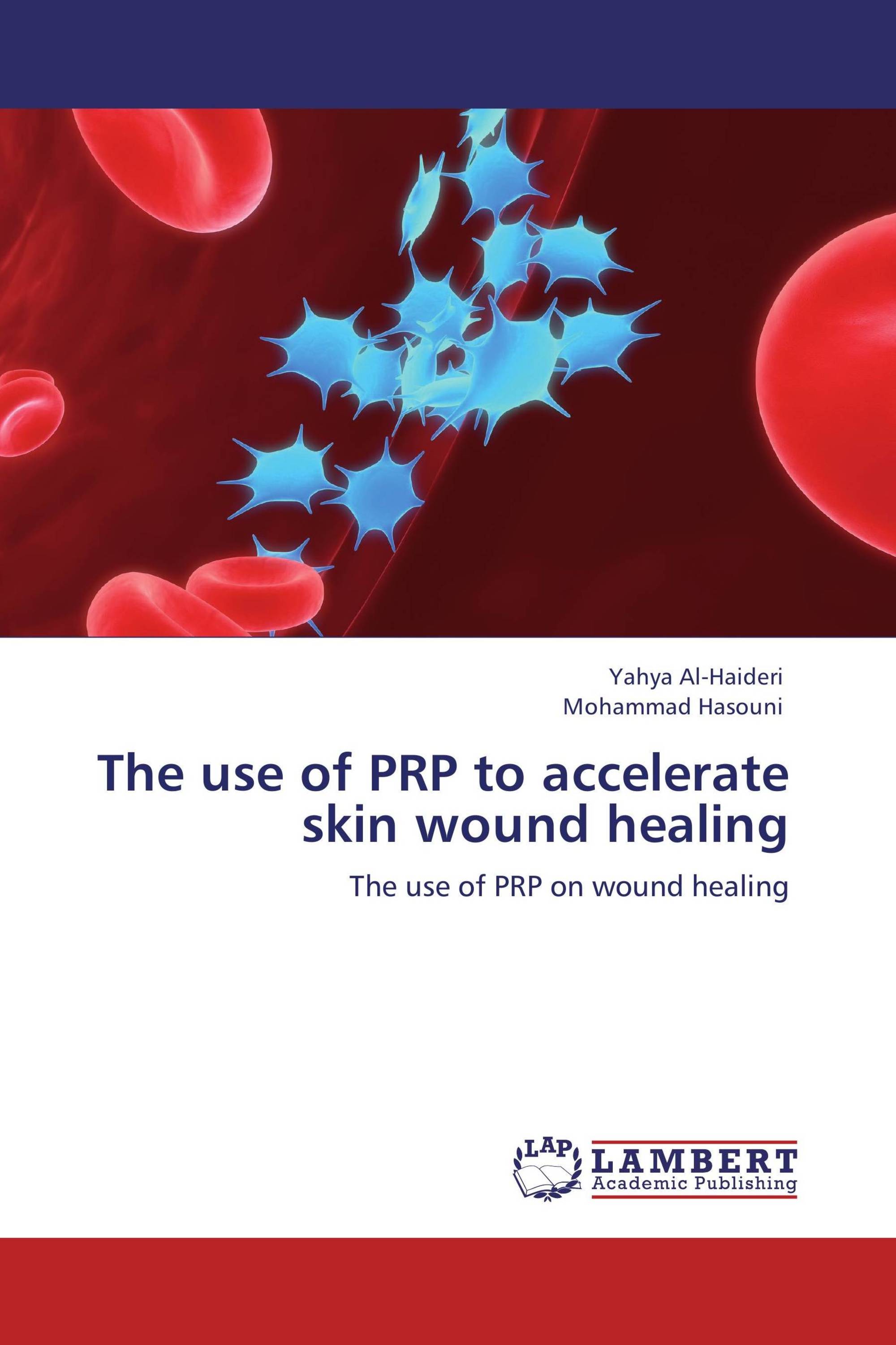 The use of PRP to accelerate skin wound healing