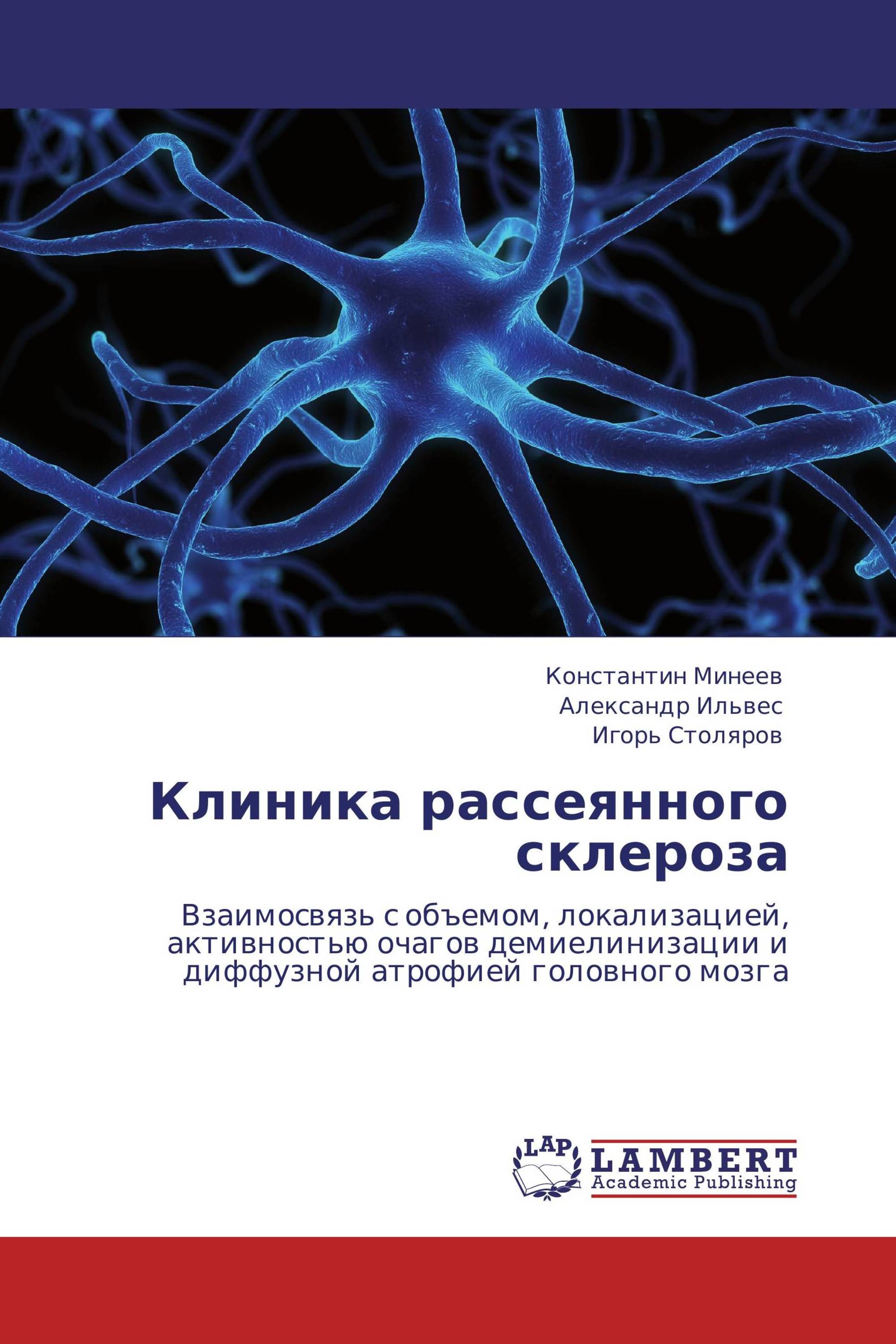 Неврология отзывы. Клиника рассеянного склероза. Рассеянный склероз неврология. Клиника рассеянного склероза неврология. Клиника склероза рассеянного склероза.