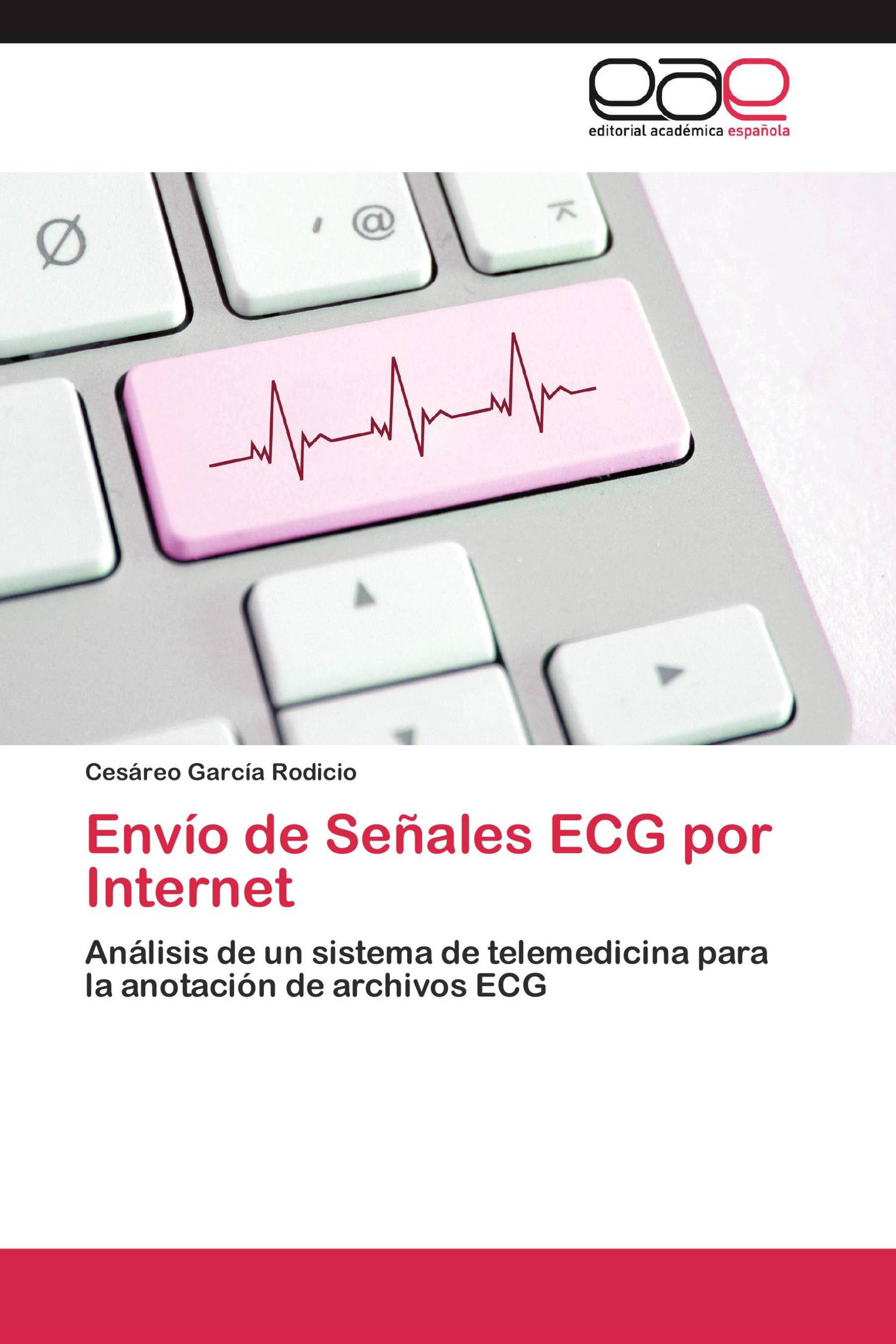 Envío de Señales ECG por Internet