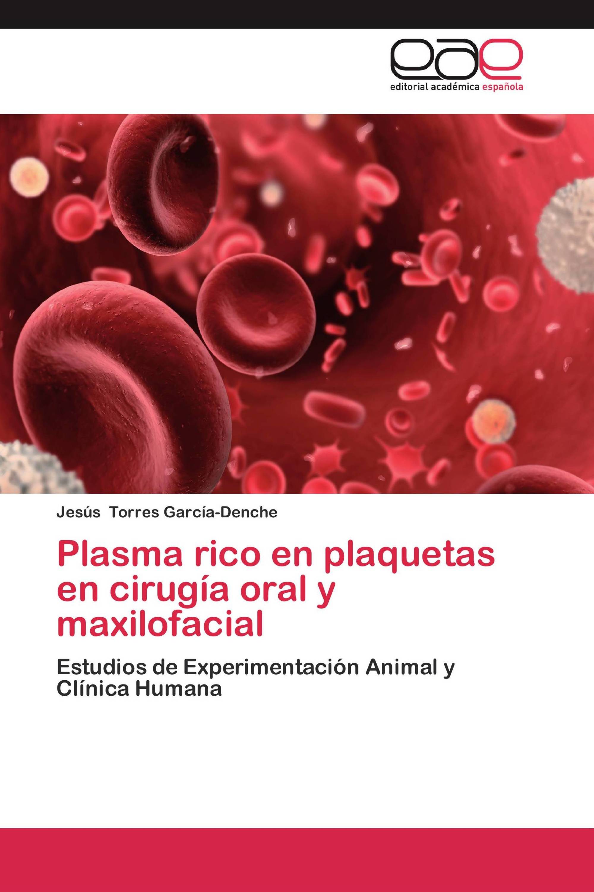 Plasma rico en plaquetas en cirugía oral y maxilofacial