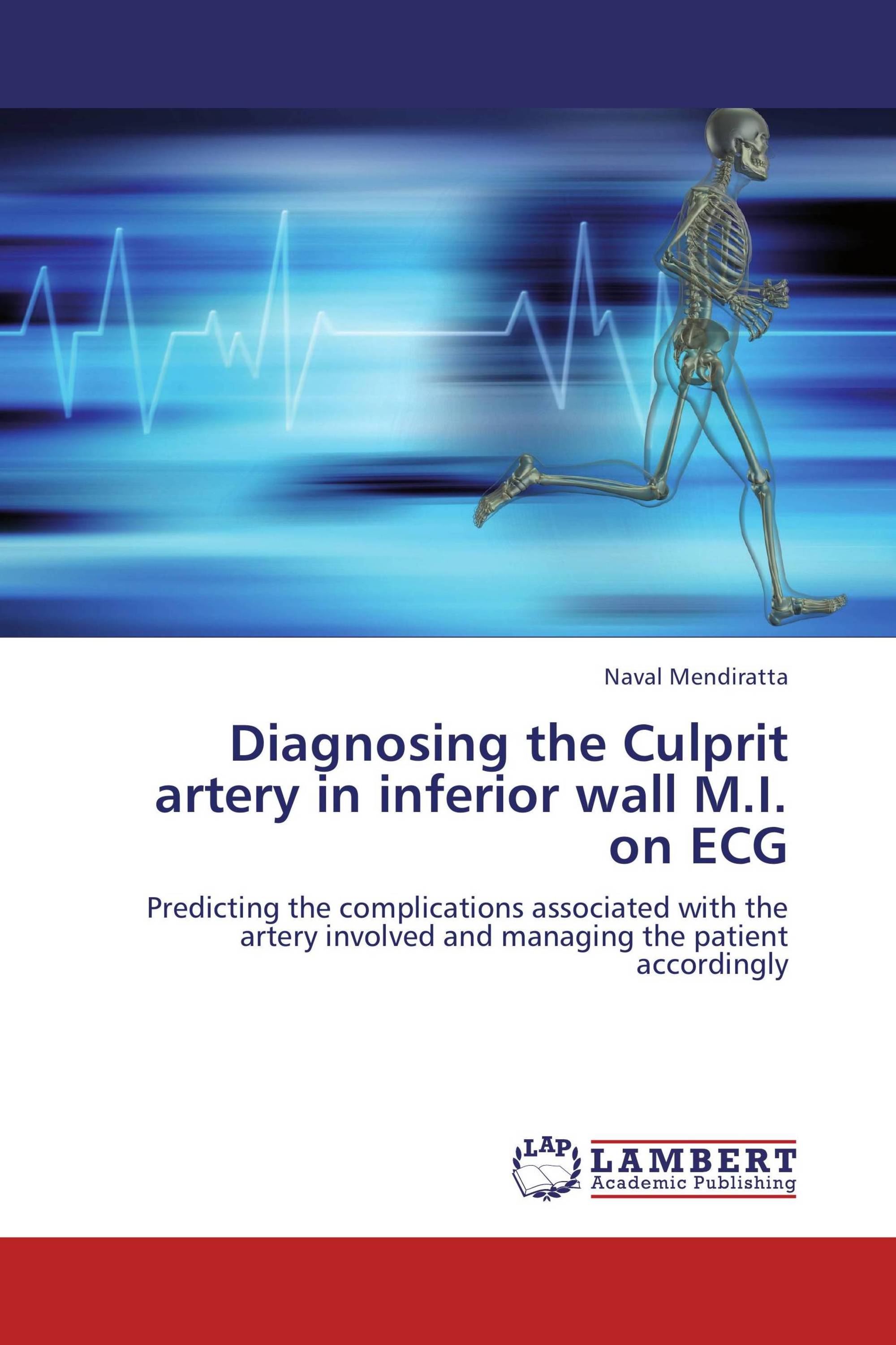 Diagnosing the Culprit artery in inferior wall M.I. on ECG