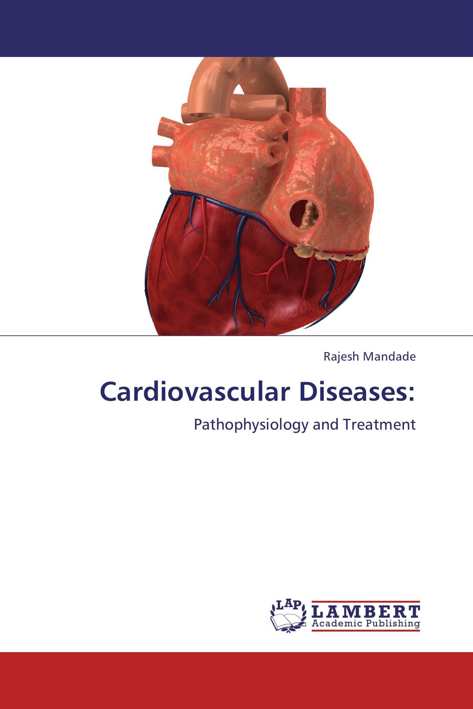 Cardiovascular Diseases: / 978-3-8473-3180-3 / 9783847331803 / 3847331809