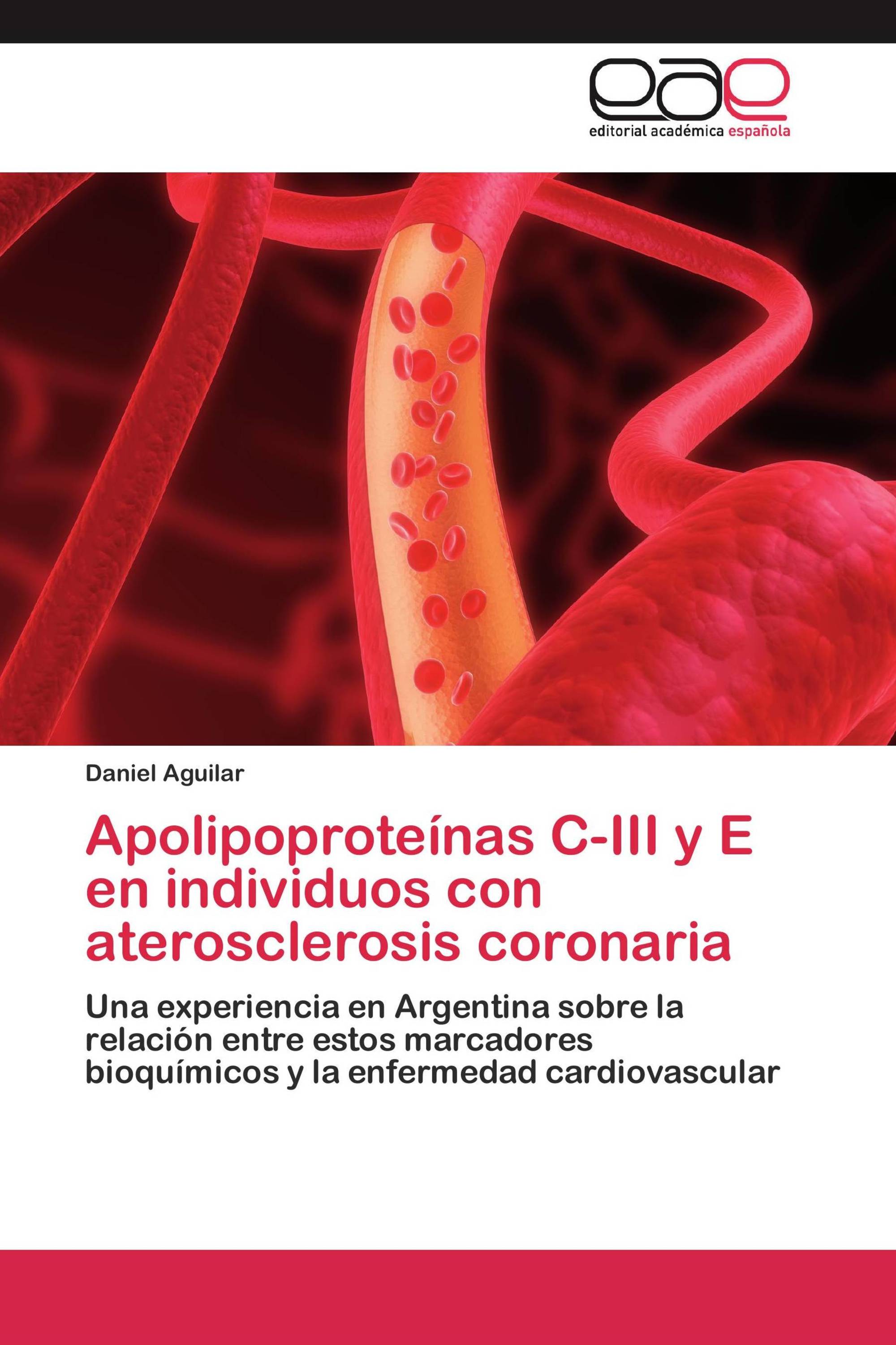 Apolipoproteínas C-III y E en individuos con aterosclerosis coronaria