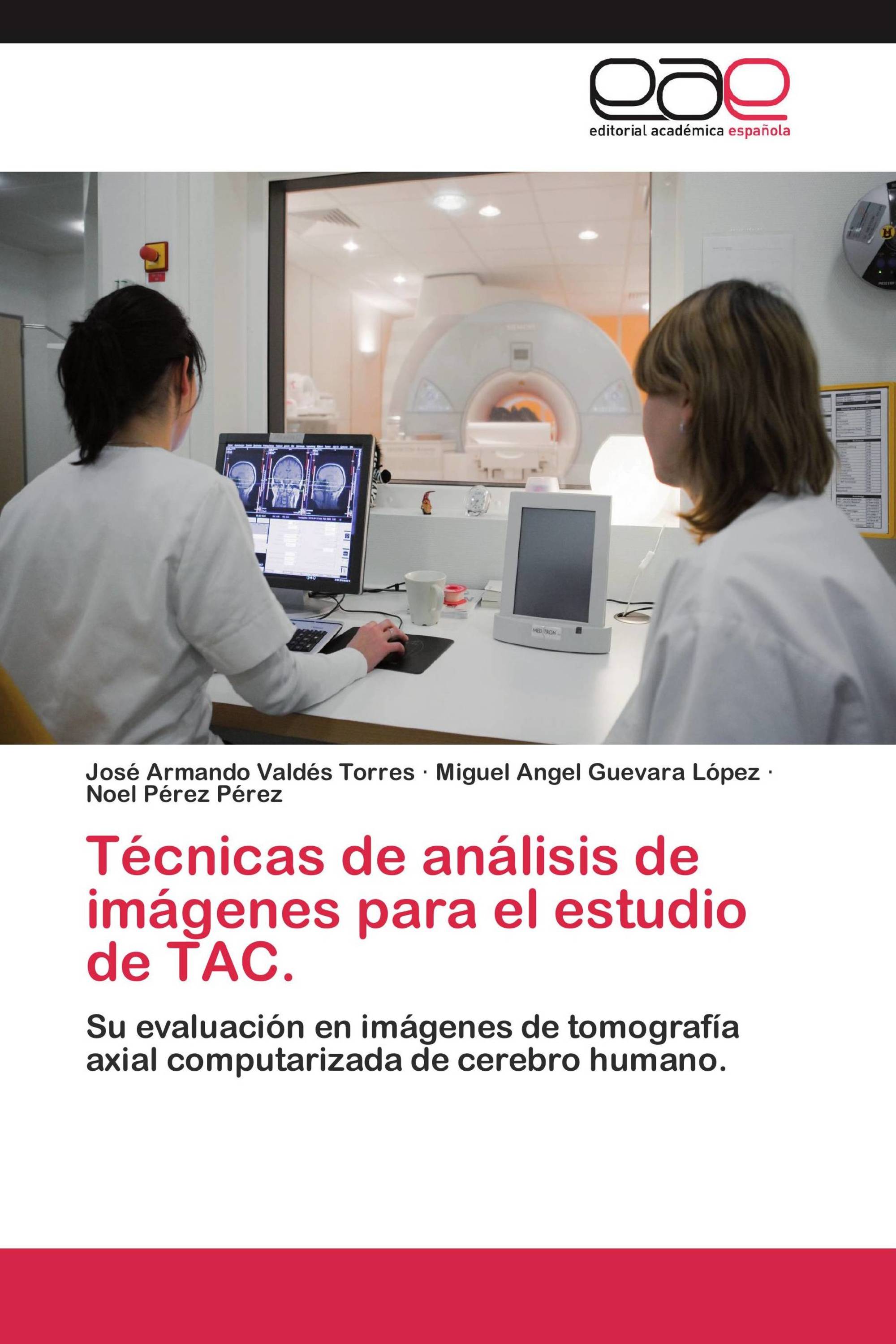 Técnicas de análisis de imágenes para el estudio de TAC.