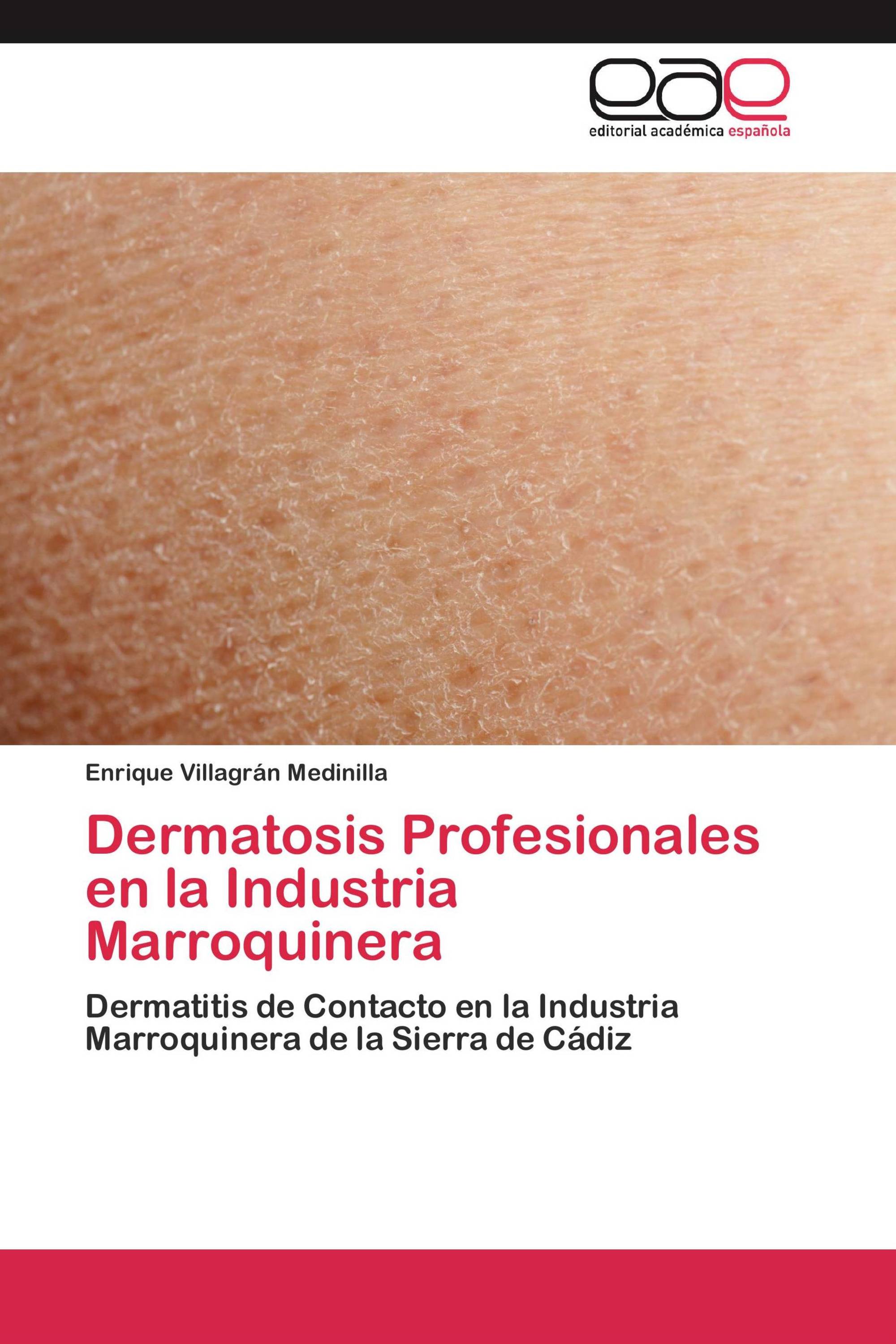 Dermatosis Profesionales en la Industria Marroquinera