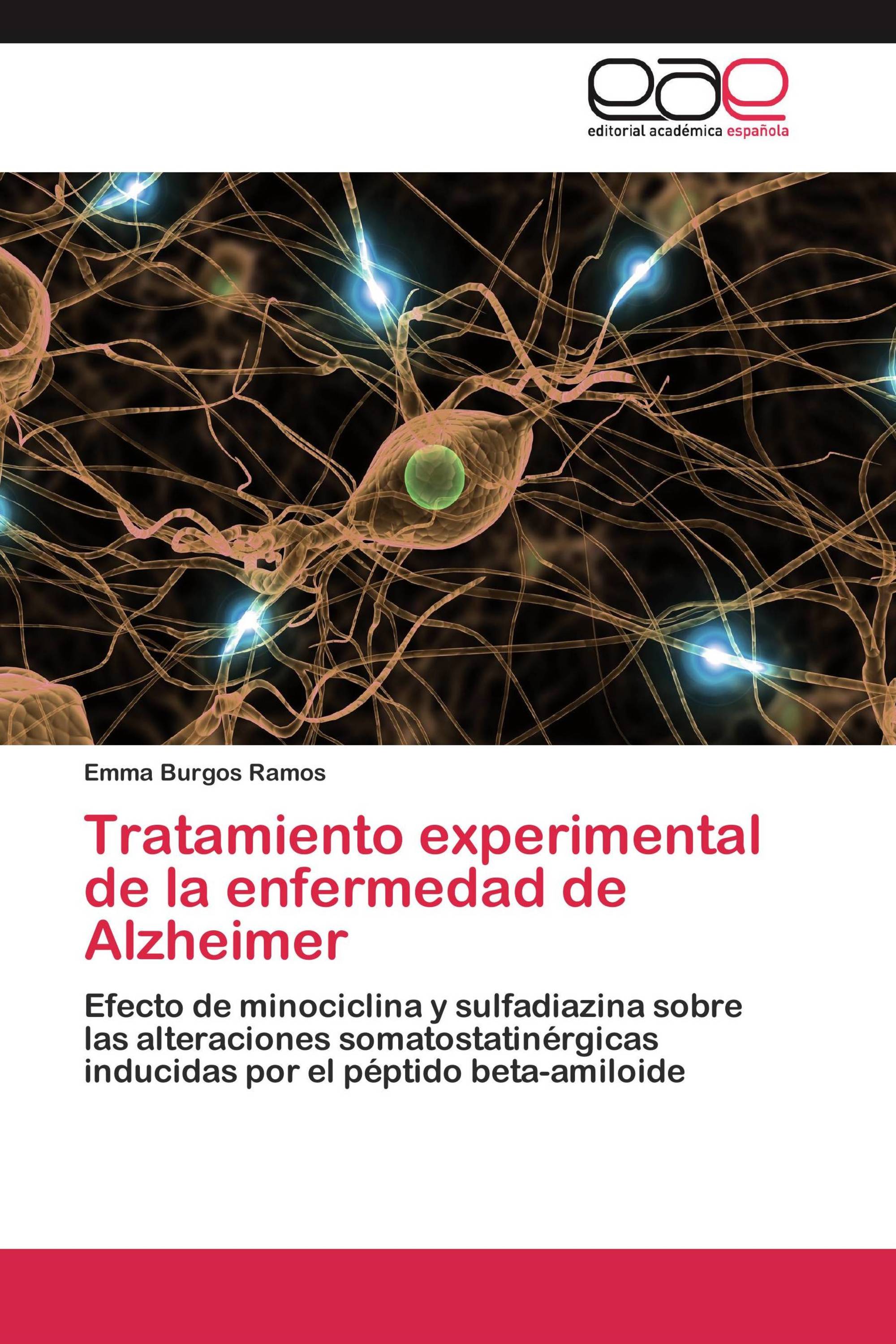 Tratamiento experimental de la enfermedad de Alzheimer