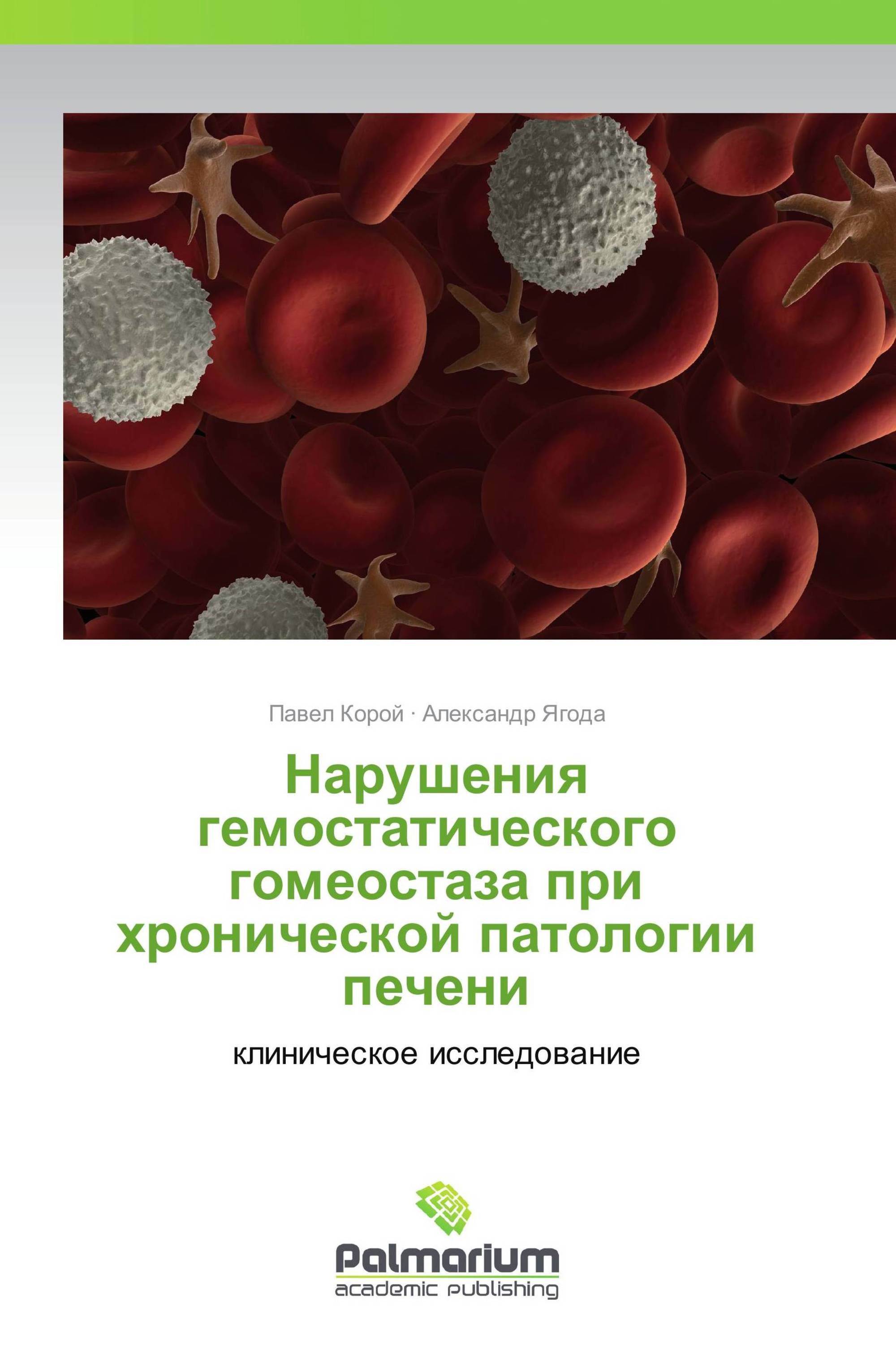 Нарушения гемостатического гомеостаза при хронической патологии печени