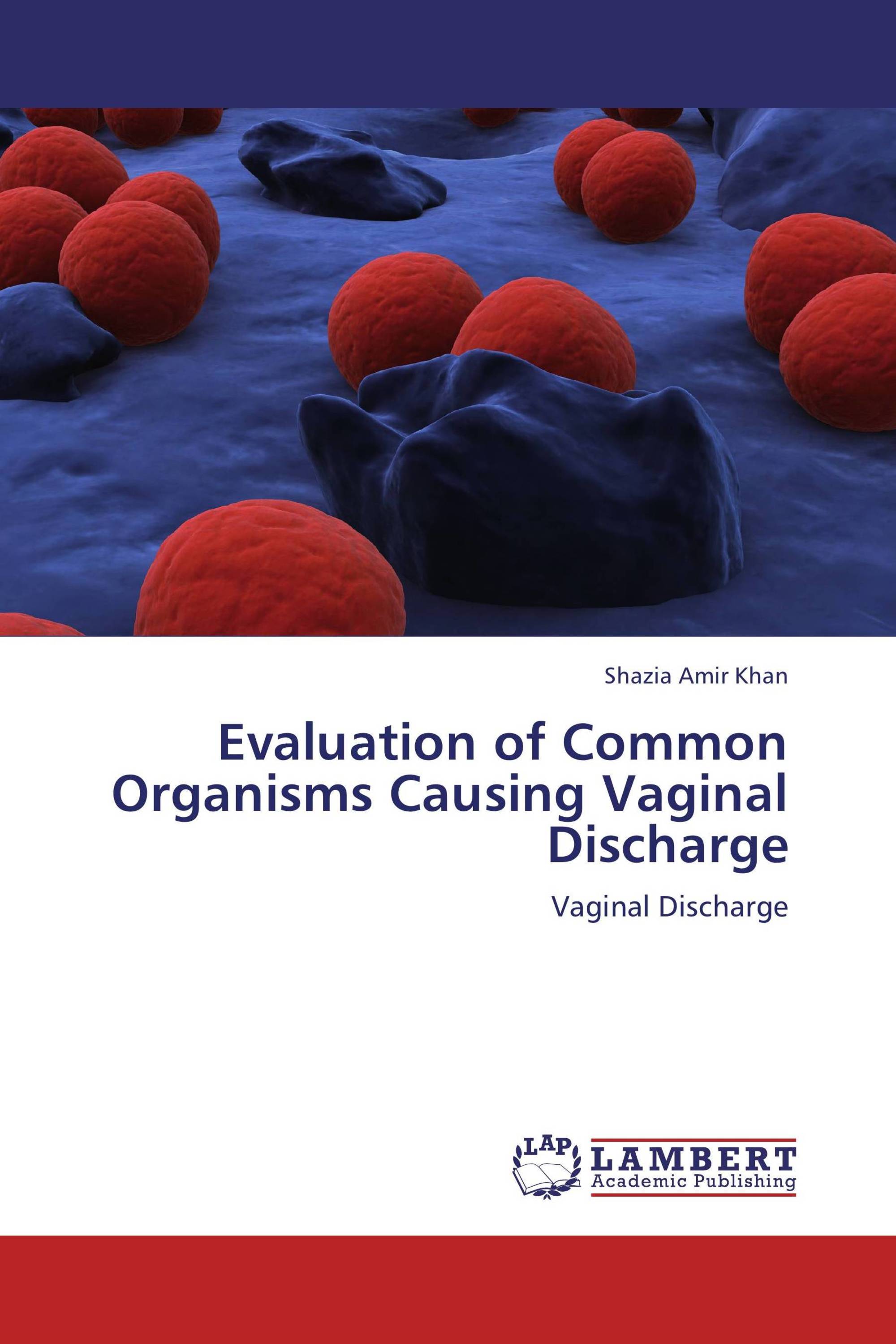 Evaluation Of Common Organisms Causing Vaginal Discharge 6157