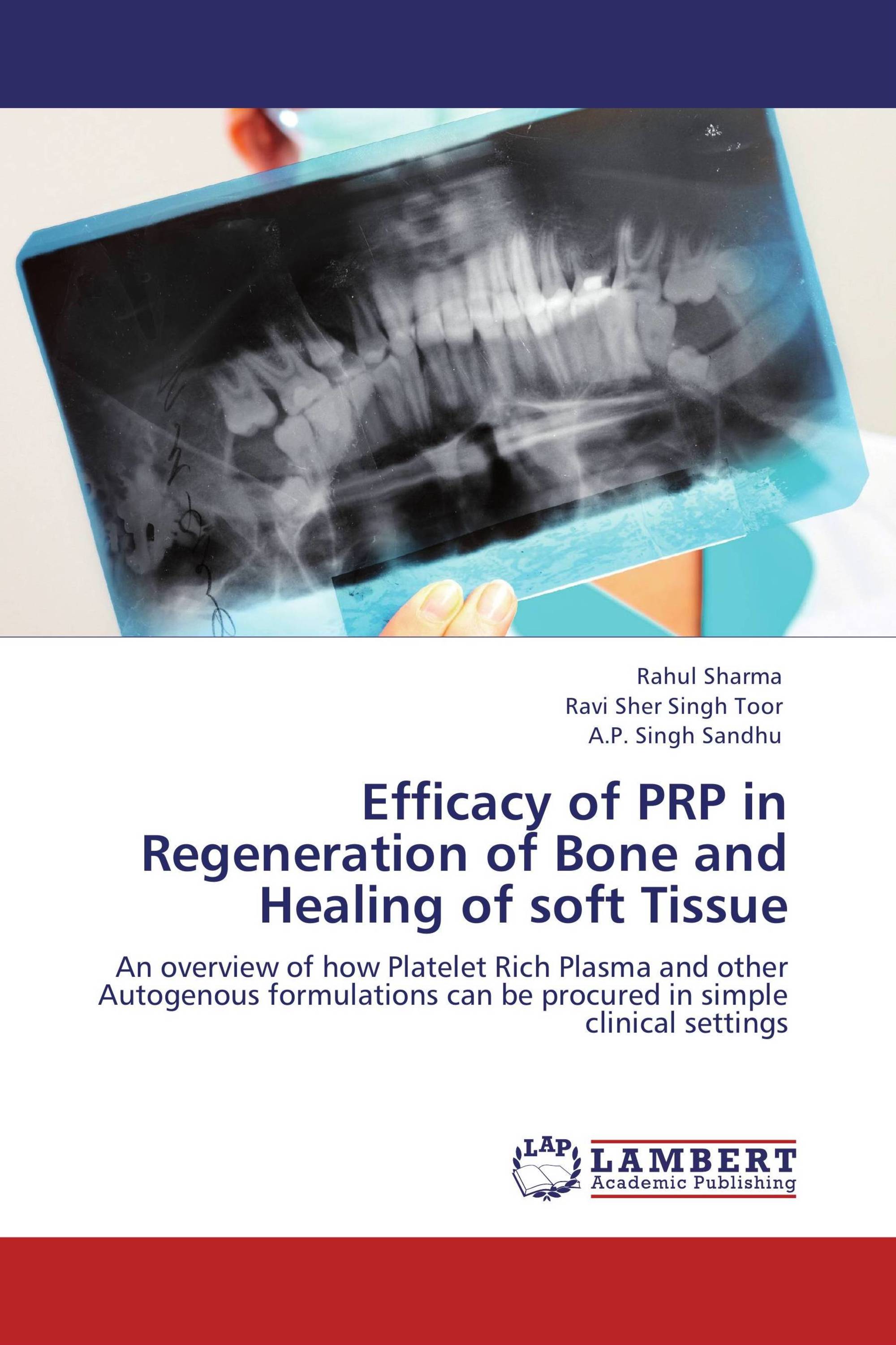 Efficacy of PRP in Regeneration of Bone and Healing of soft Tissue