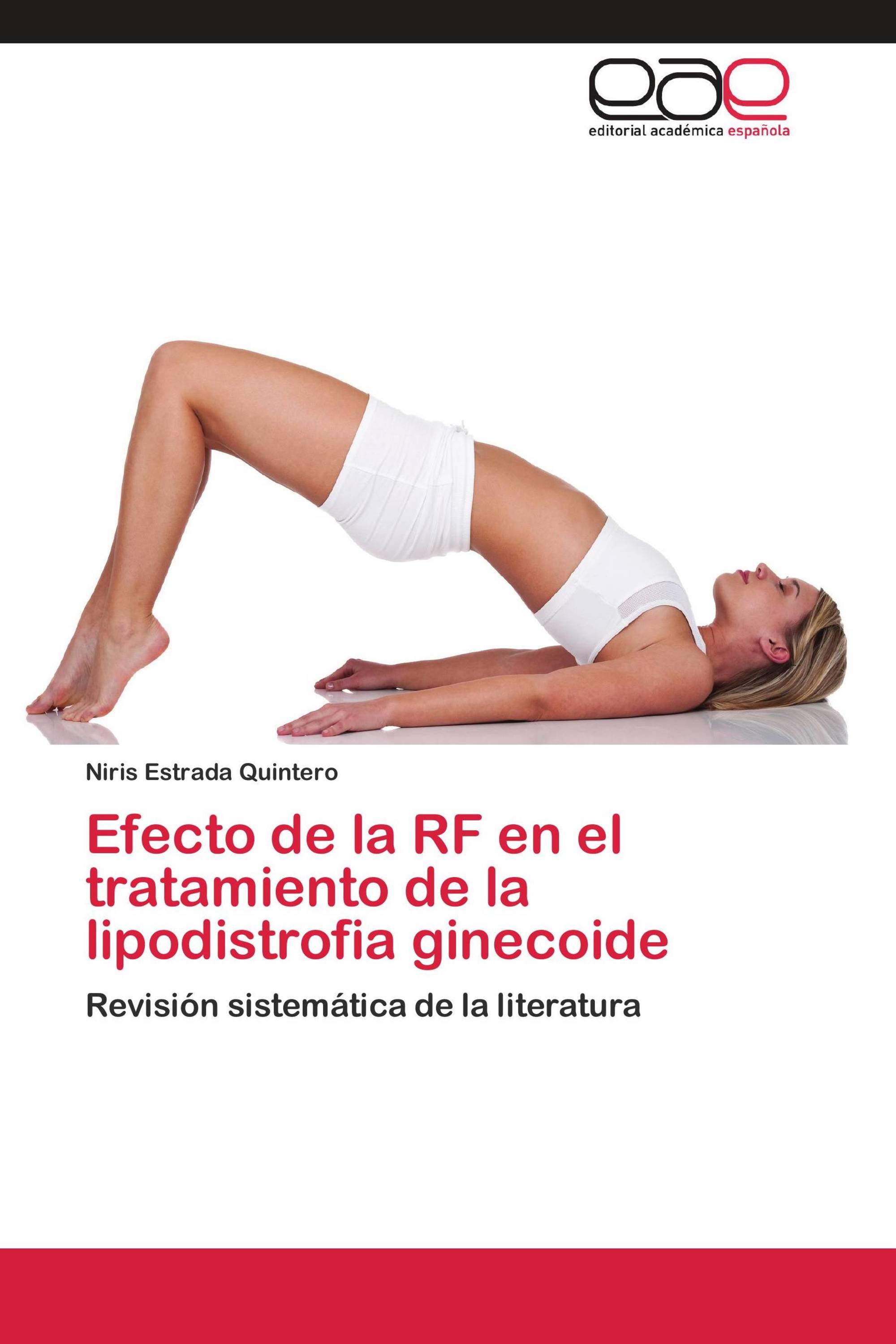 Efecto de la RF en el tratamiento de la lipodistrofia ginecoide