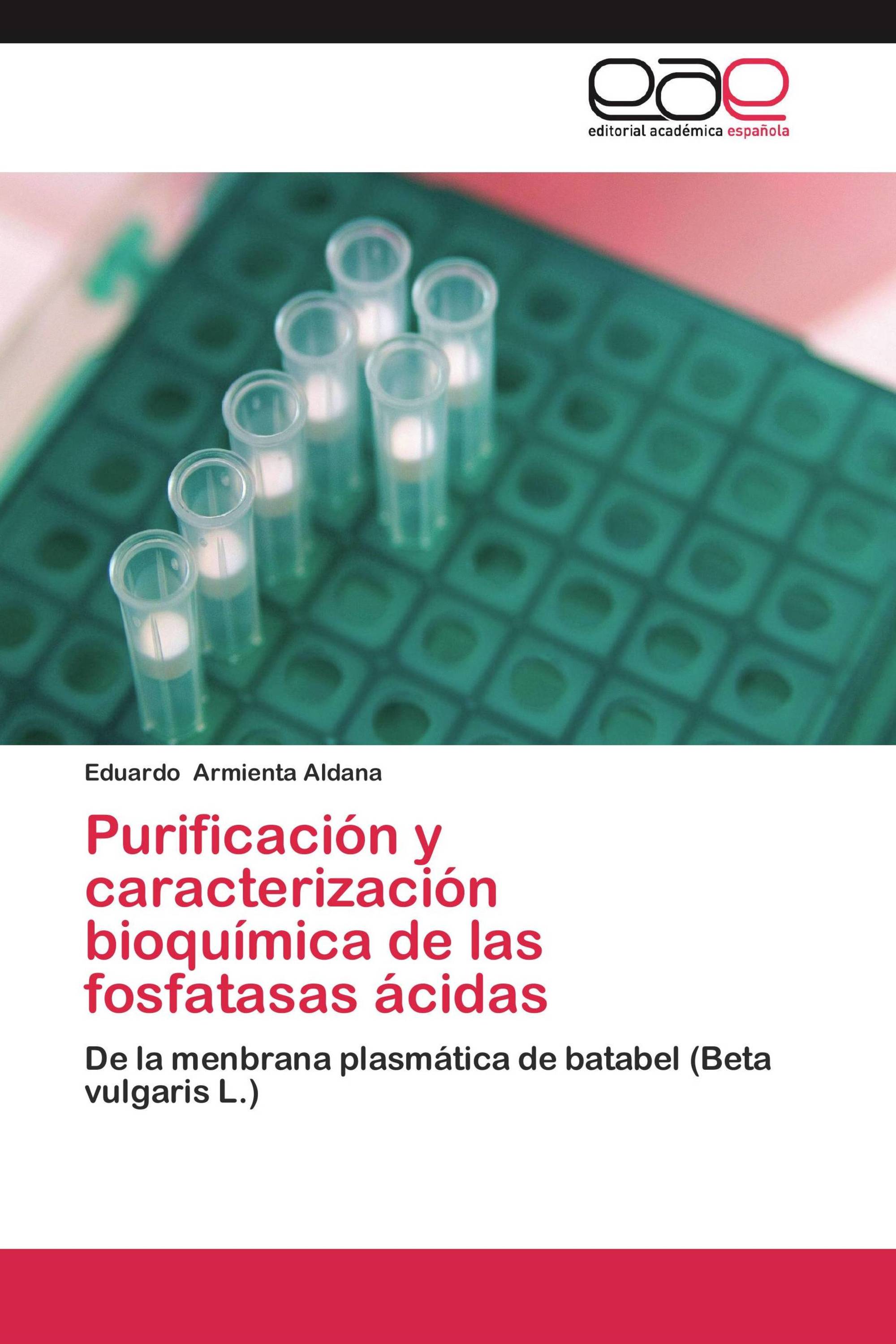 Purificación y caracterización bioquímica de las fosfatasas ácidas