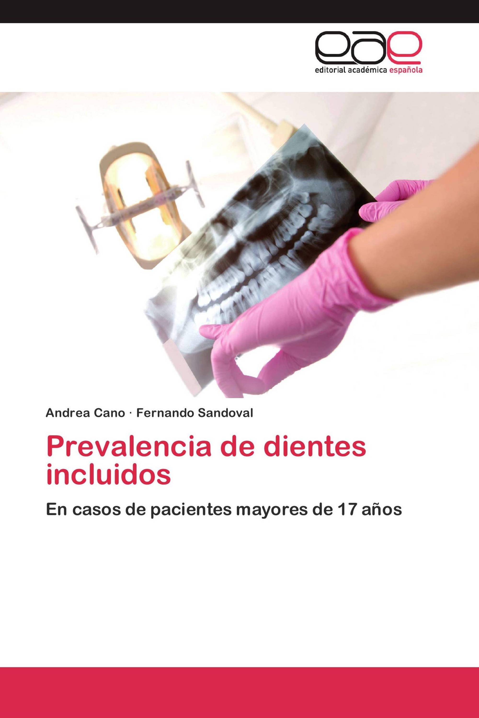 Prevalencia de dientes incluidos