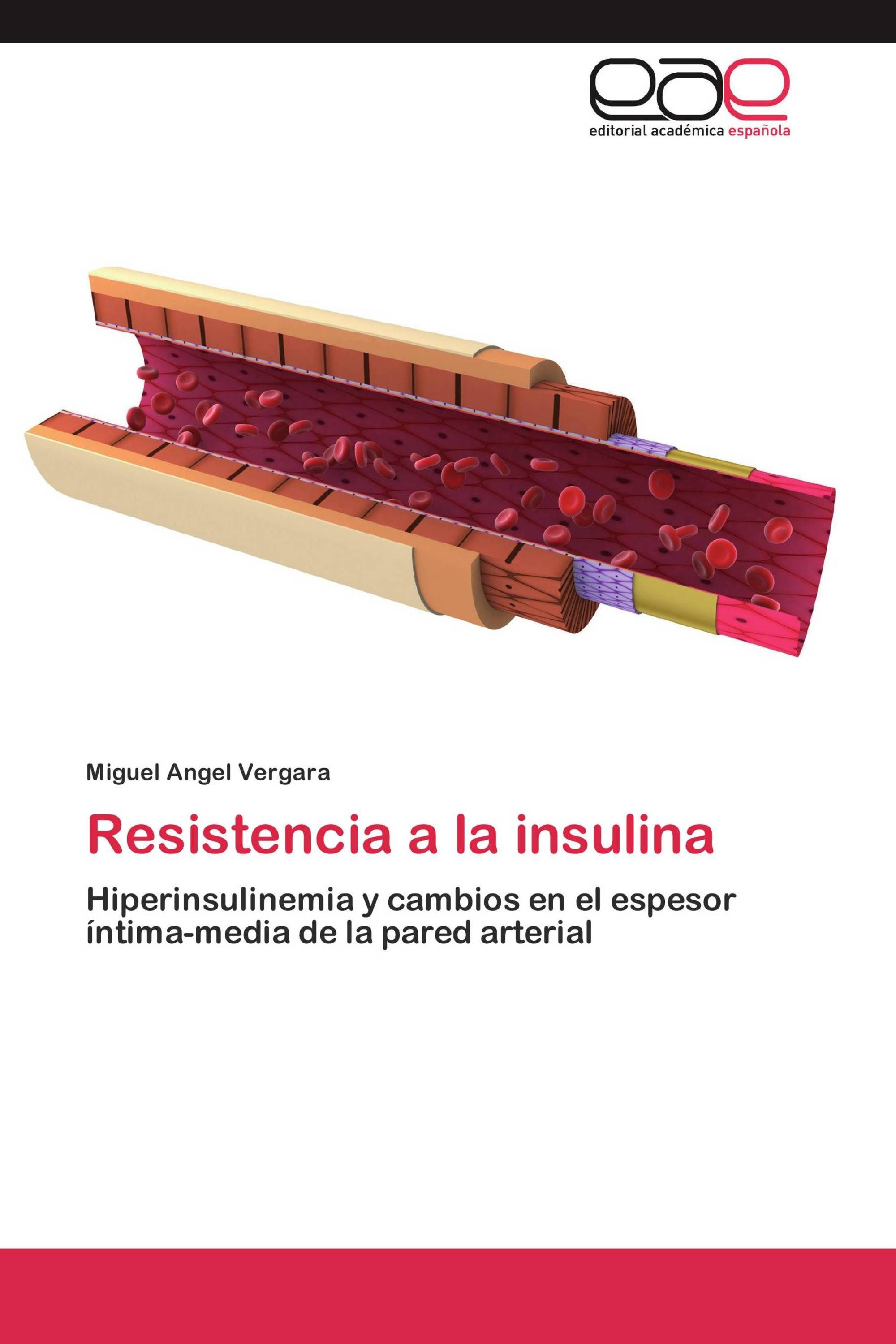 Resistencia a la insulina