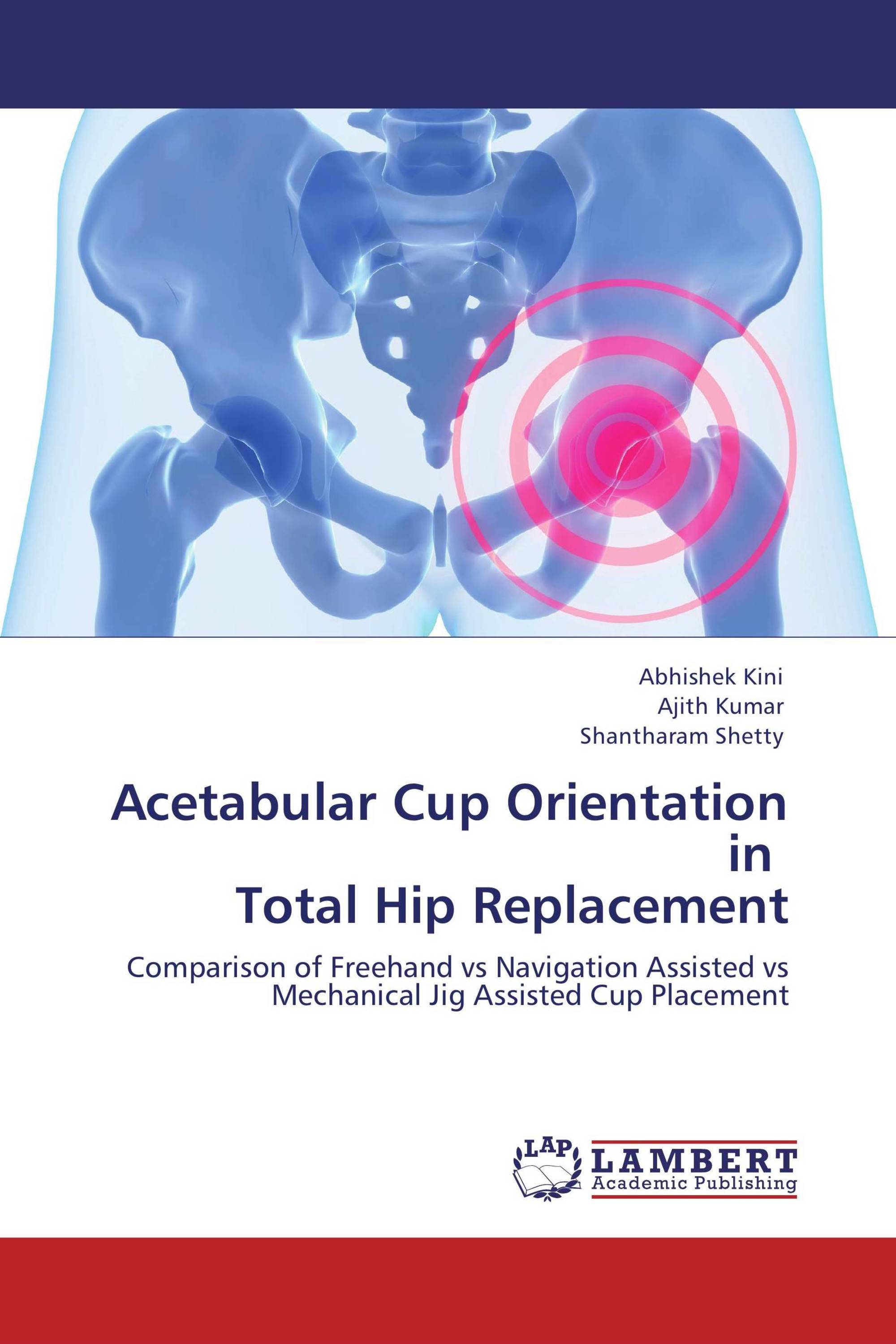 Hip replacement thesis 05 image