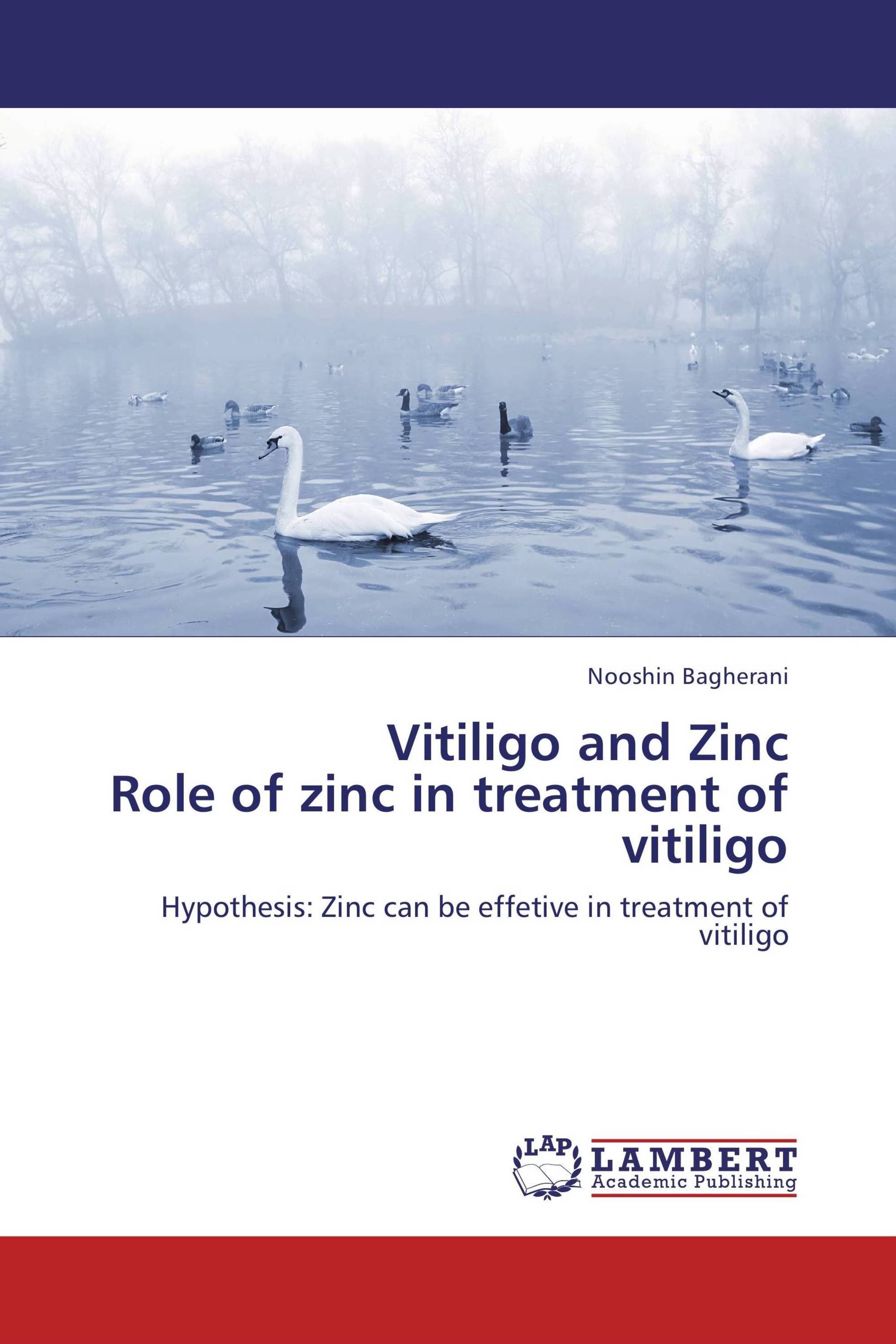 Vitiligo and Zinc  Role of zinc in treatment of vitiligo