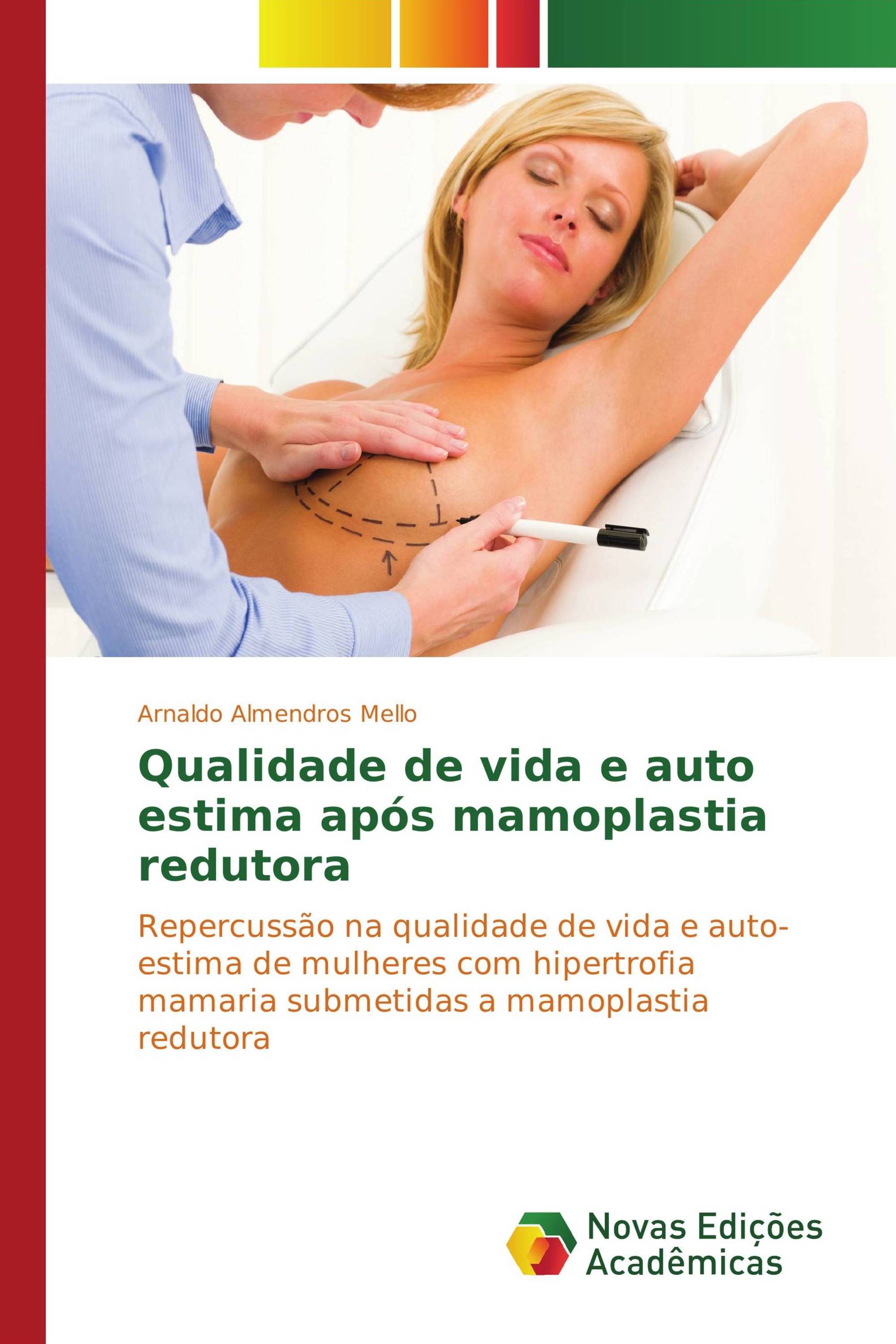 Qualidade de vida e auto estima após mamoplastia redutora