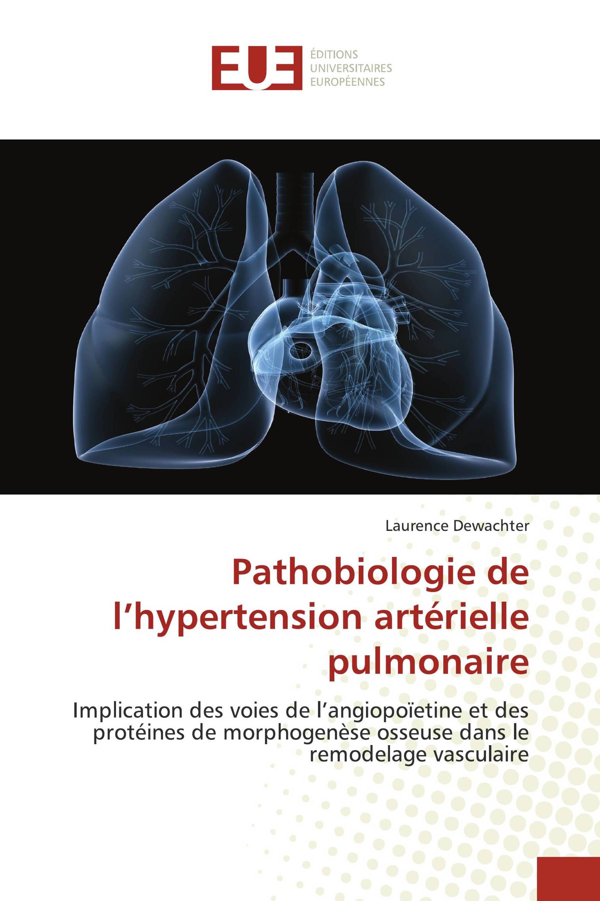 Pathobiologie de l’hypertension artérielle pulmonaire