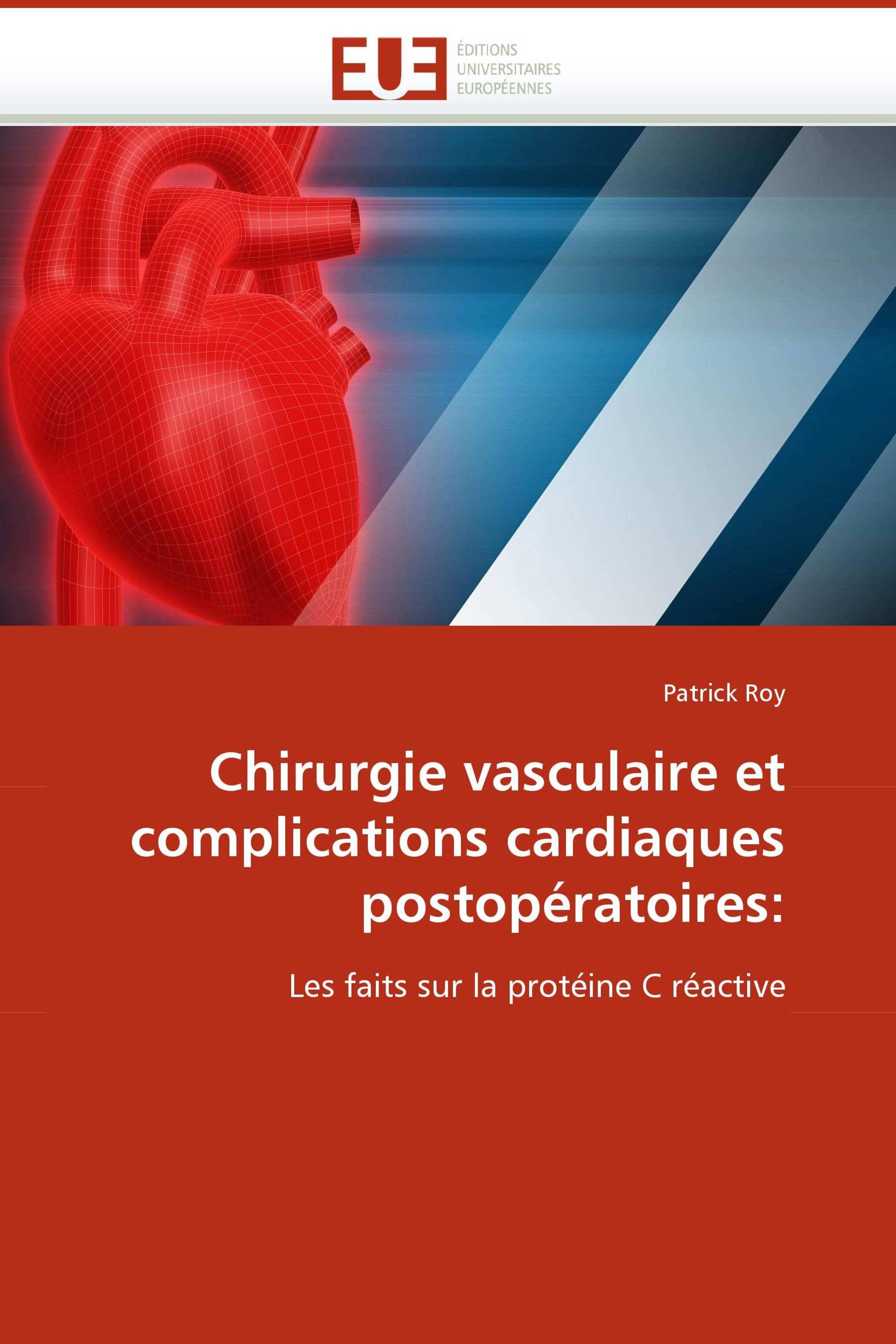 Chirurgie vasculaire et complications cardiaques postopératoires: