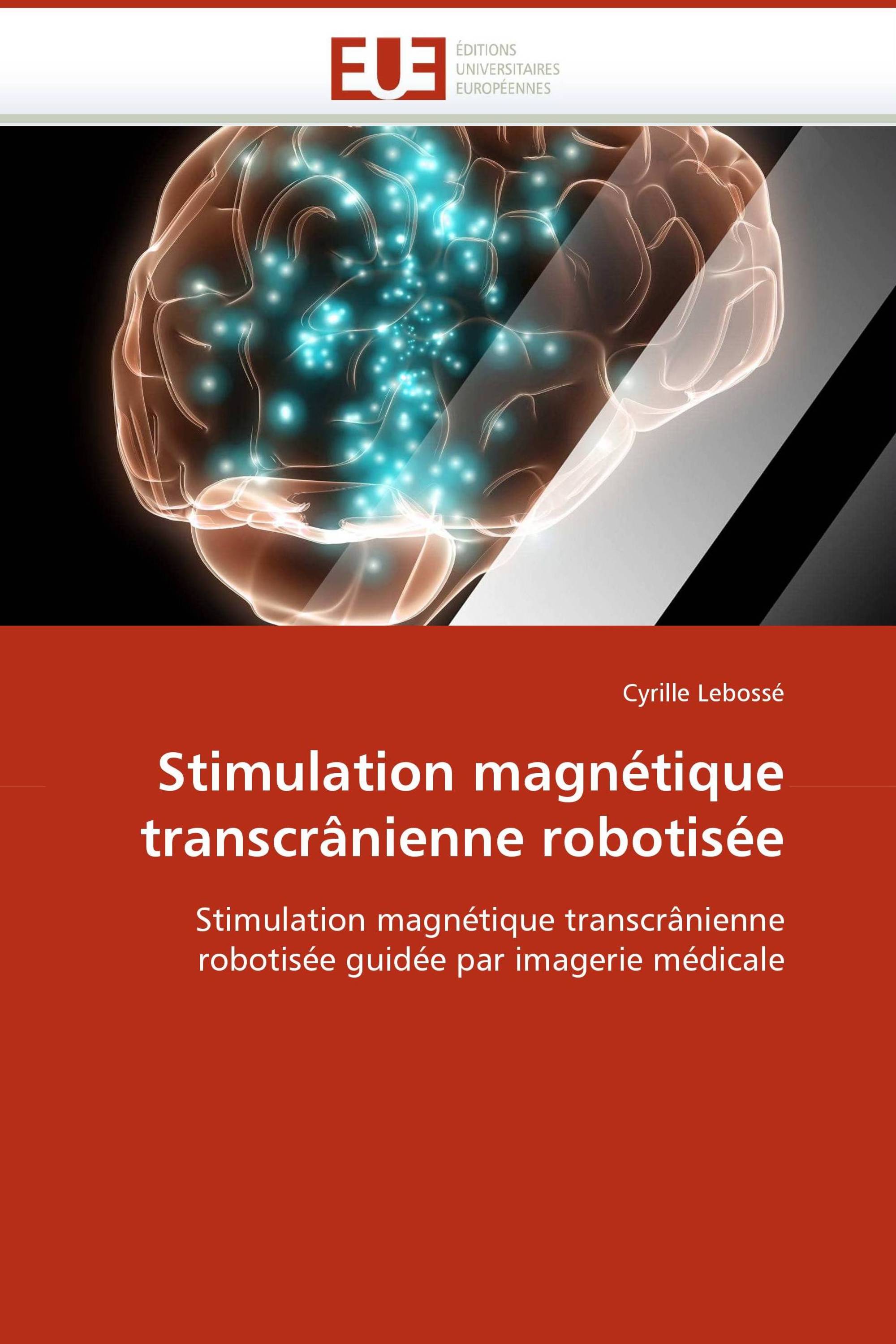 Stimulation magnétique transcrânienne robotisée / 978-613-1-51029 ...