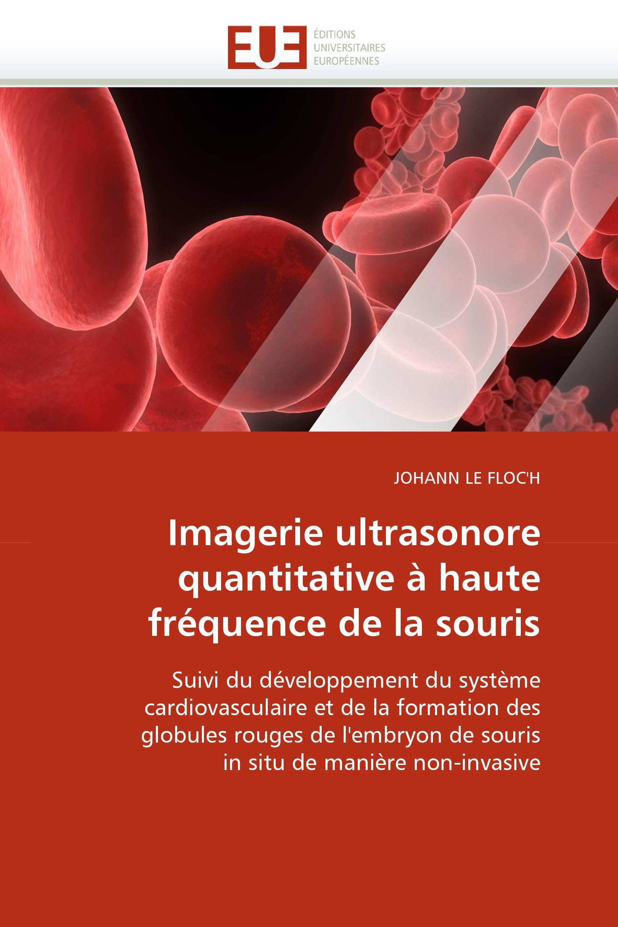 Imagerie ultrasonore quantitative à haute fréquence de la souris