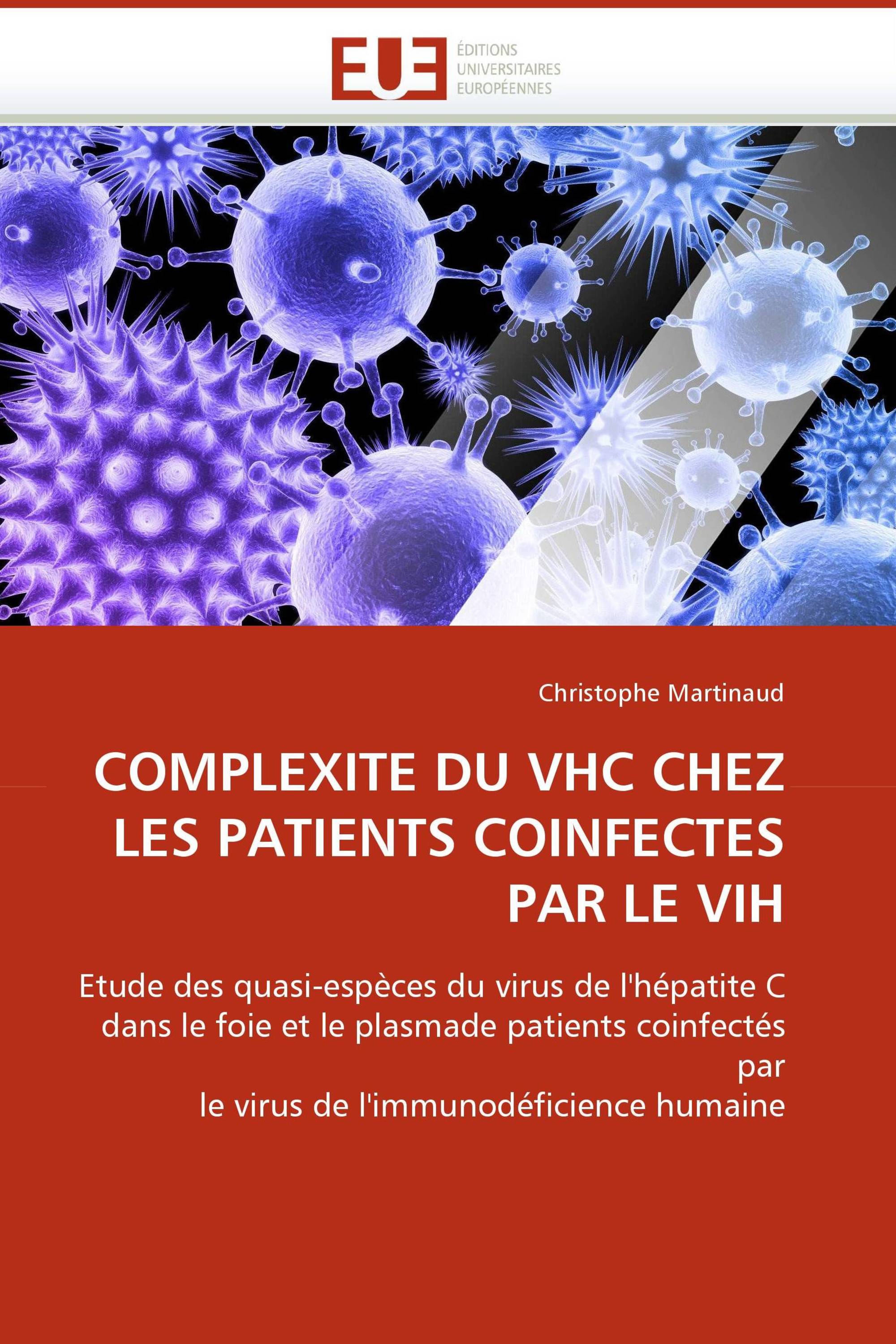 COMPLEXITE DU VHC CHEZ LES PATIENTS COINFECTES PAR LE VIH